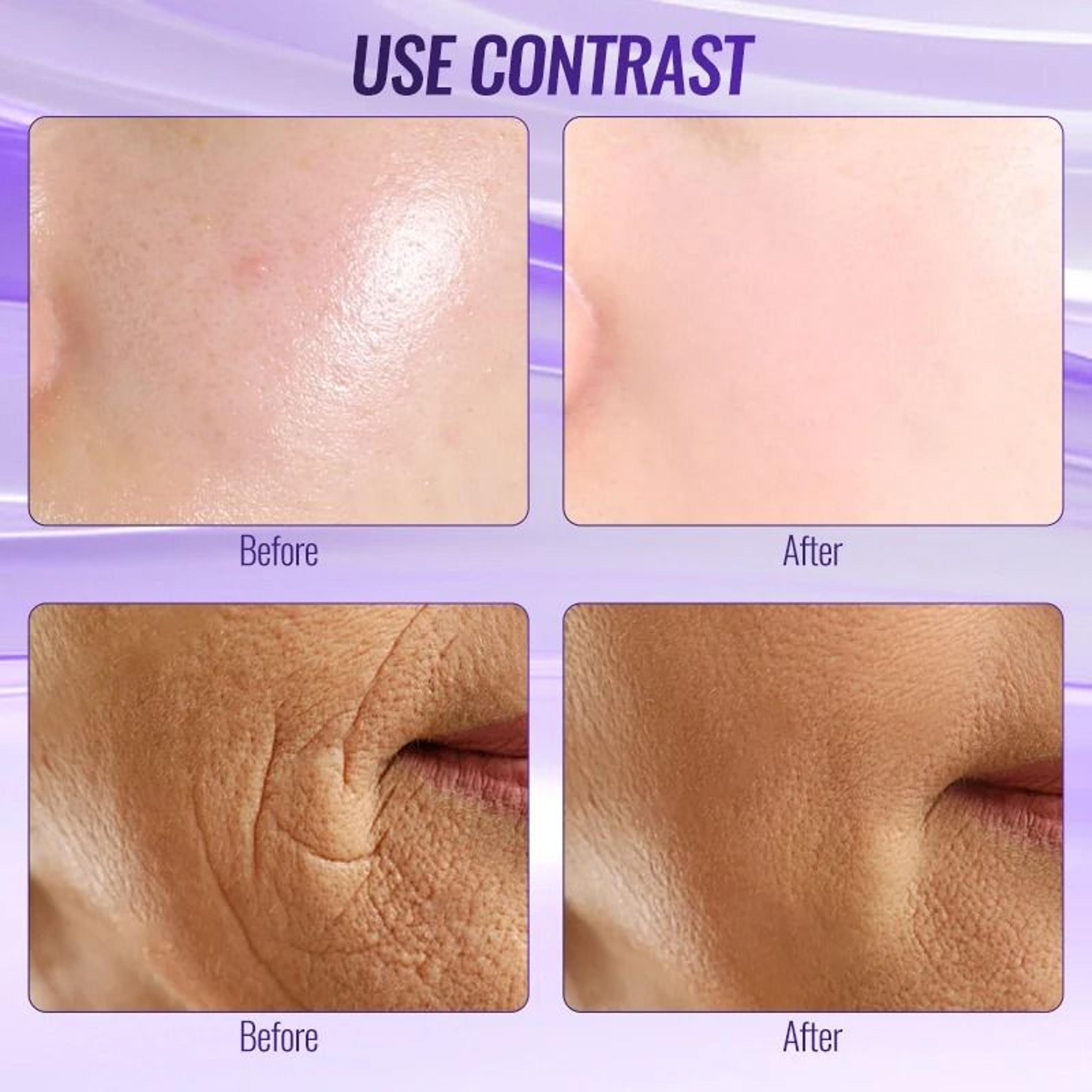 Professional High Frequency Facial Wand 6 In 1 1