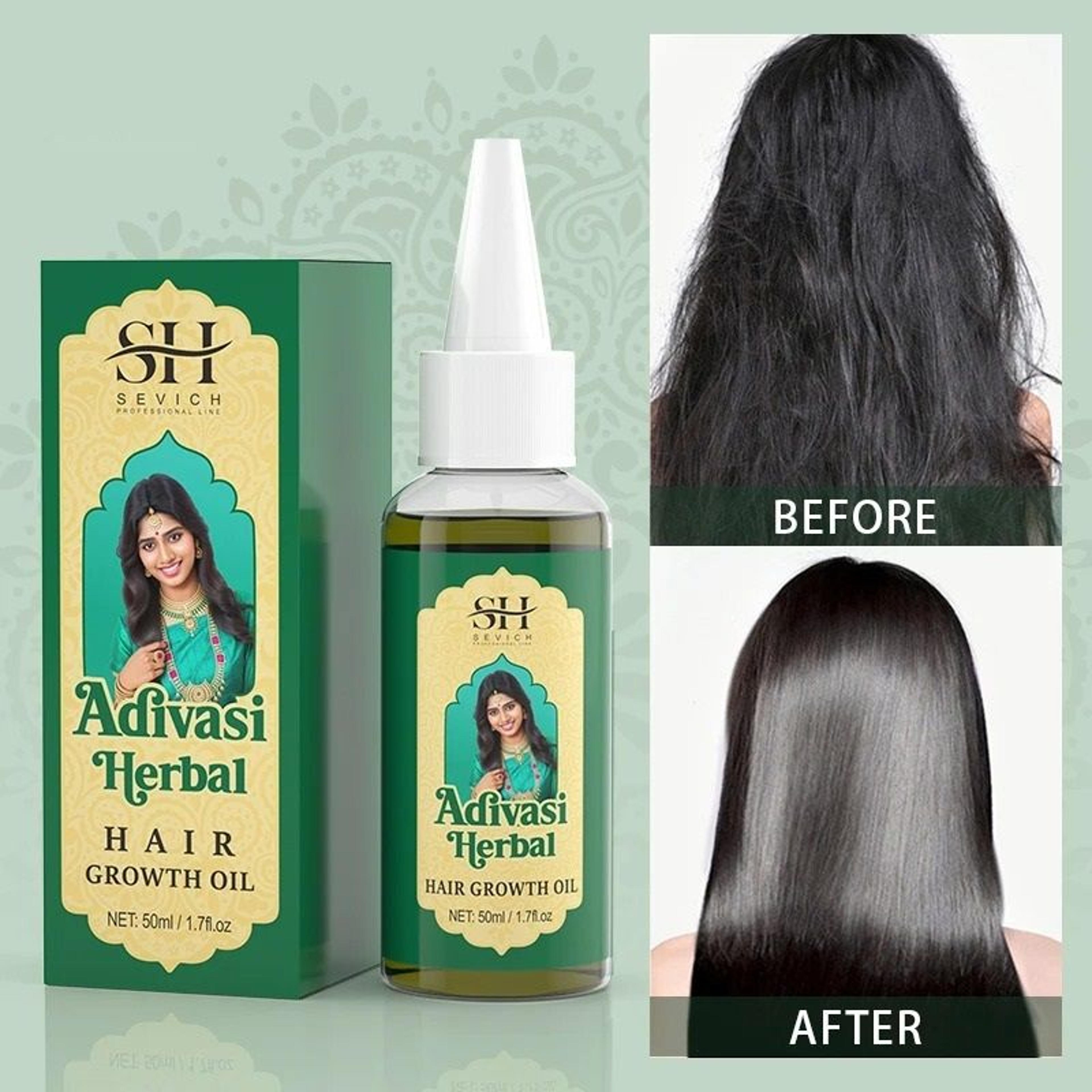 Herbal Hair Growth Oil For Thicker Fuller Stronger Hair 1