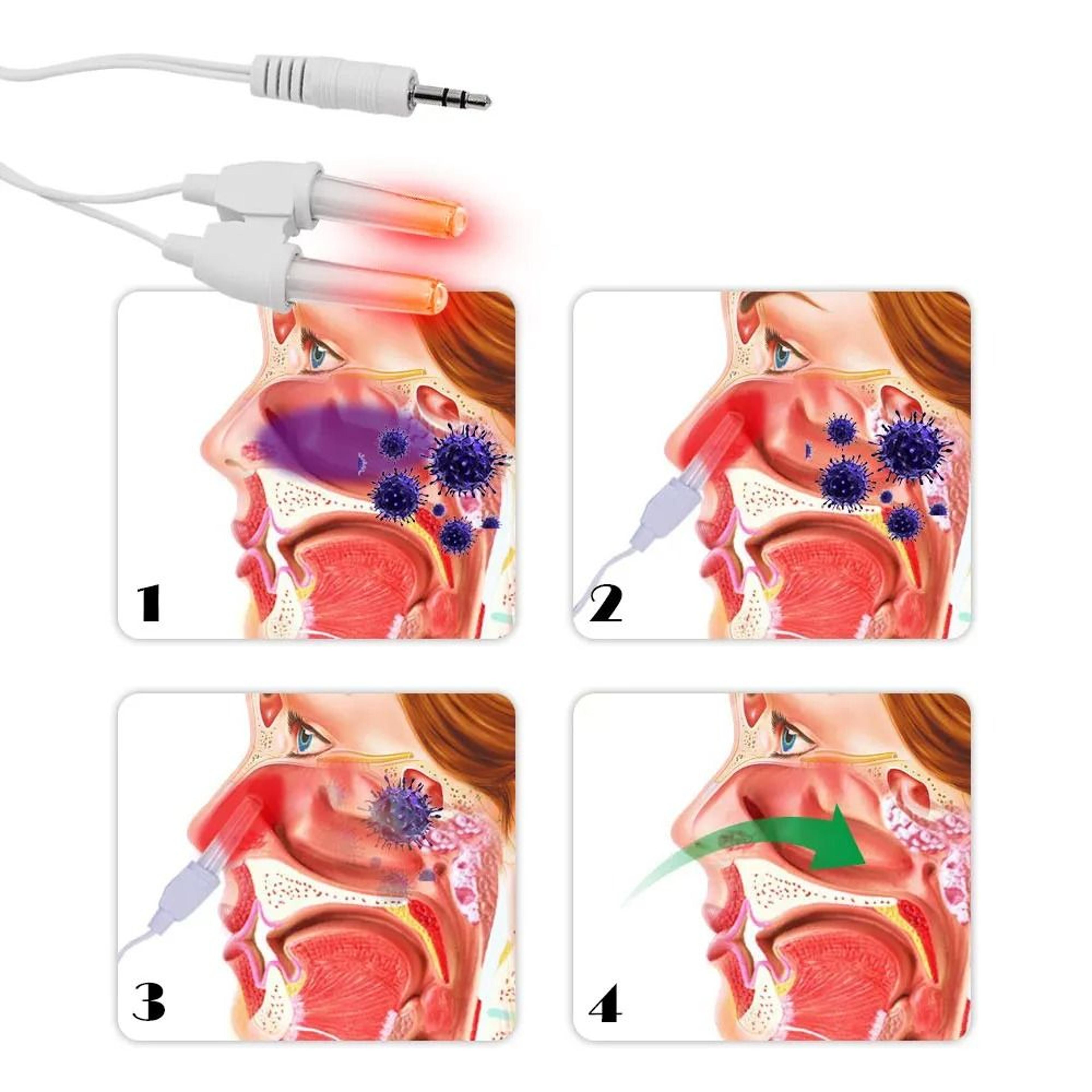 Dual Action Sinus Relief And Nasal Light Therapy System 5