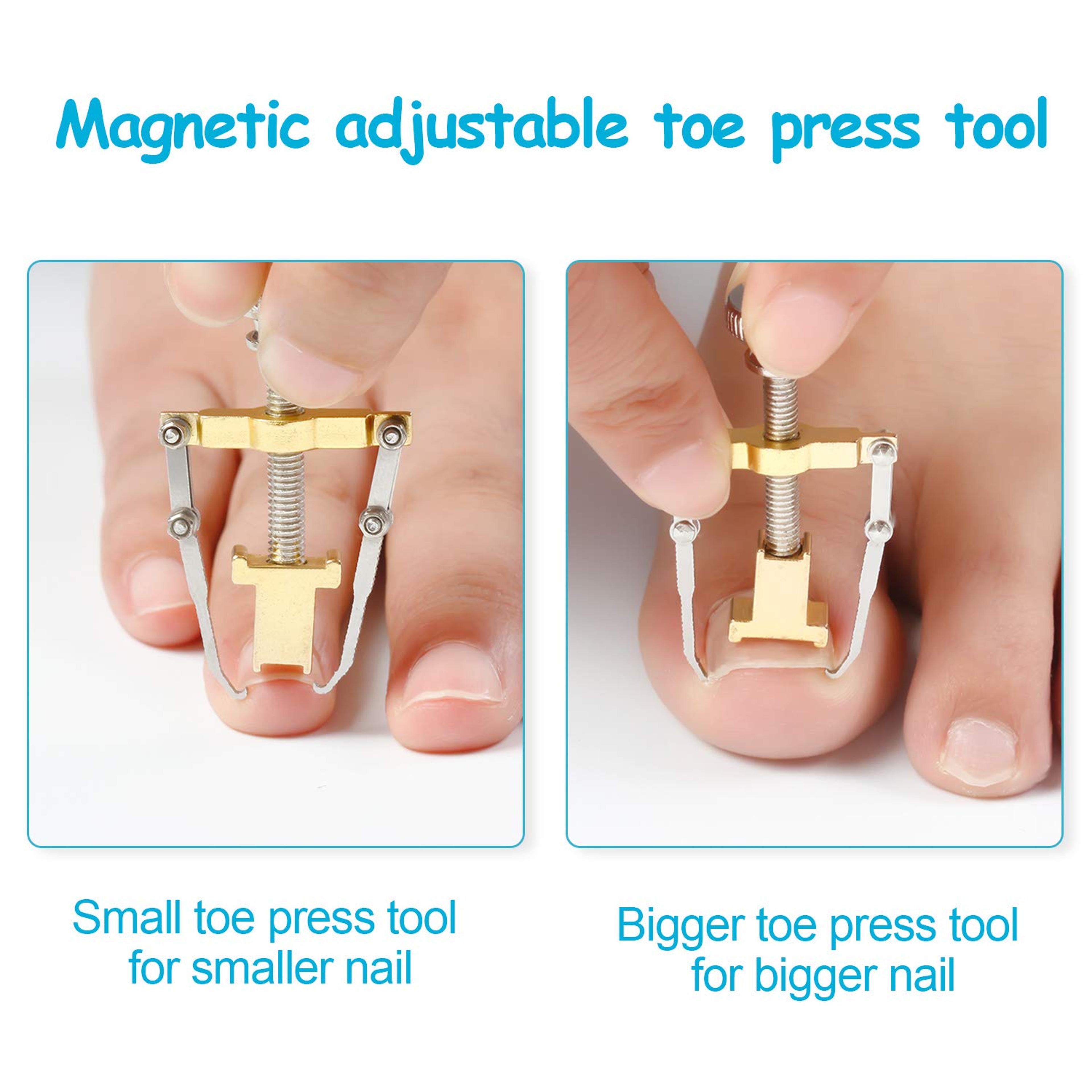 Ingrown Toe Nail Fixer Device (7).jpg