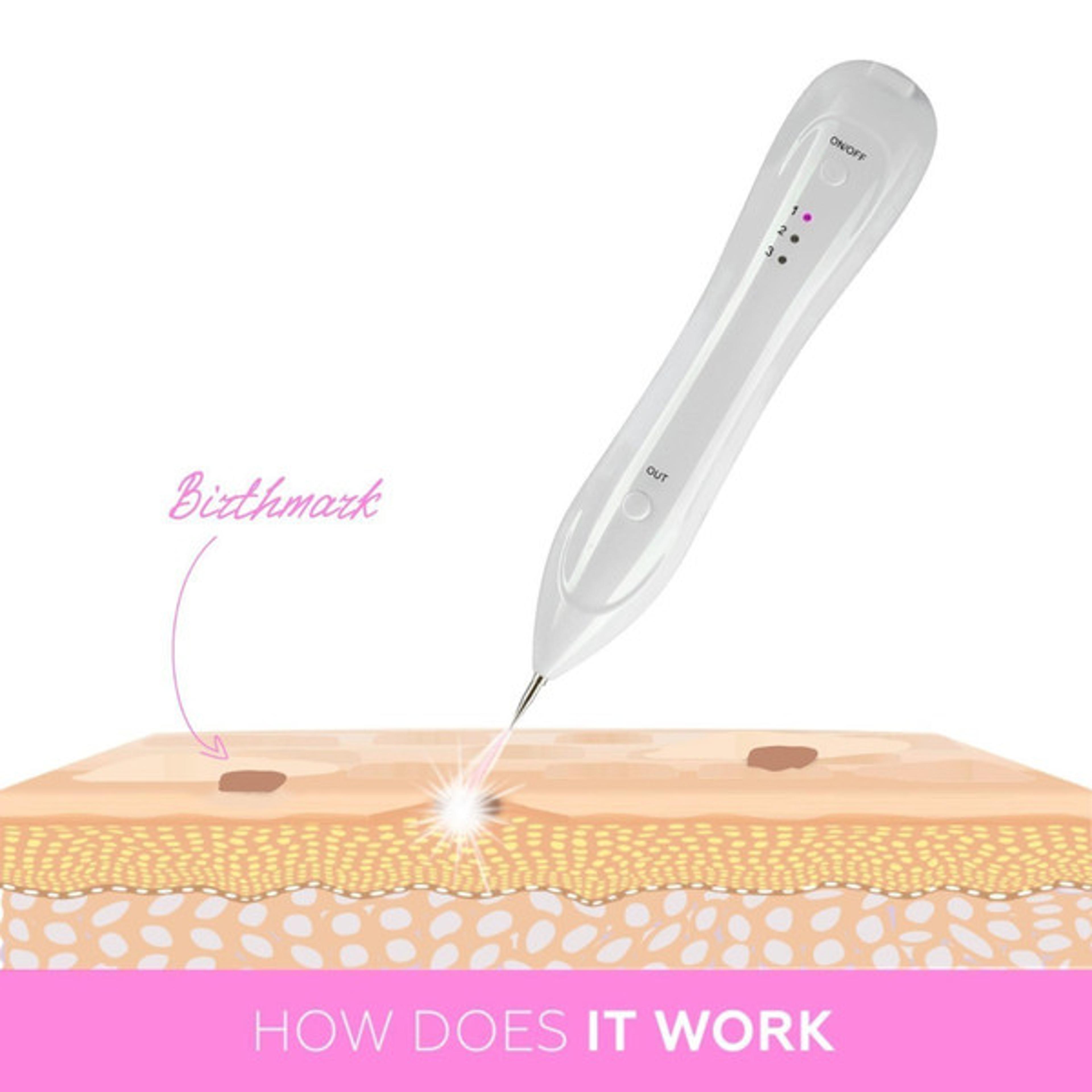 Revolutionary Skin Care Plasma Pen - USB Rechargeable Skin Tag & Mole Remover with 2200 mAh Long-Lasting Battery 1