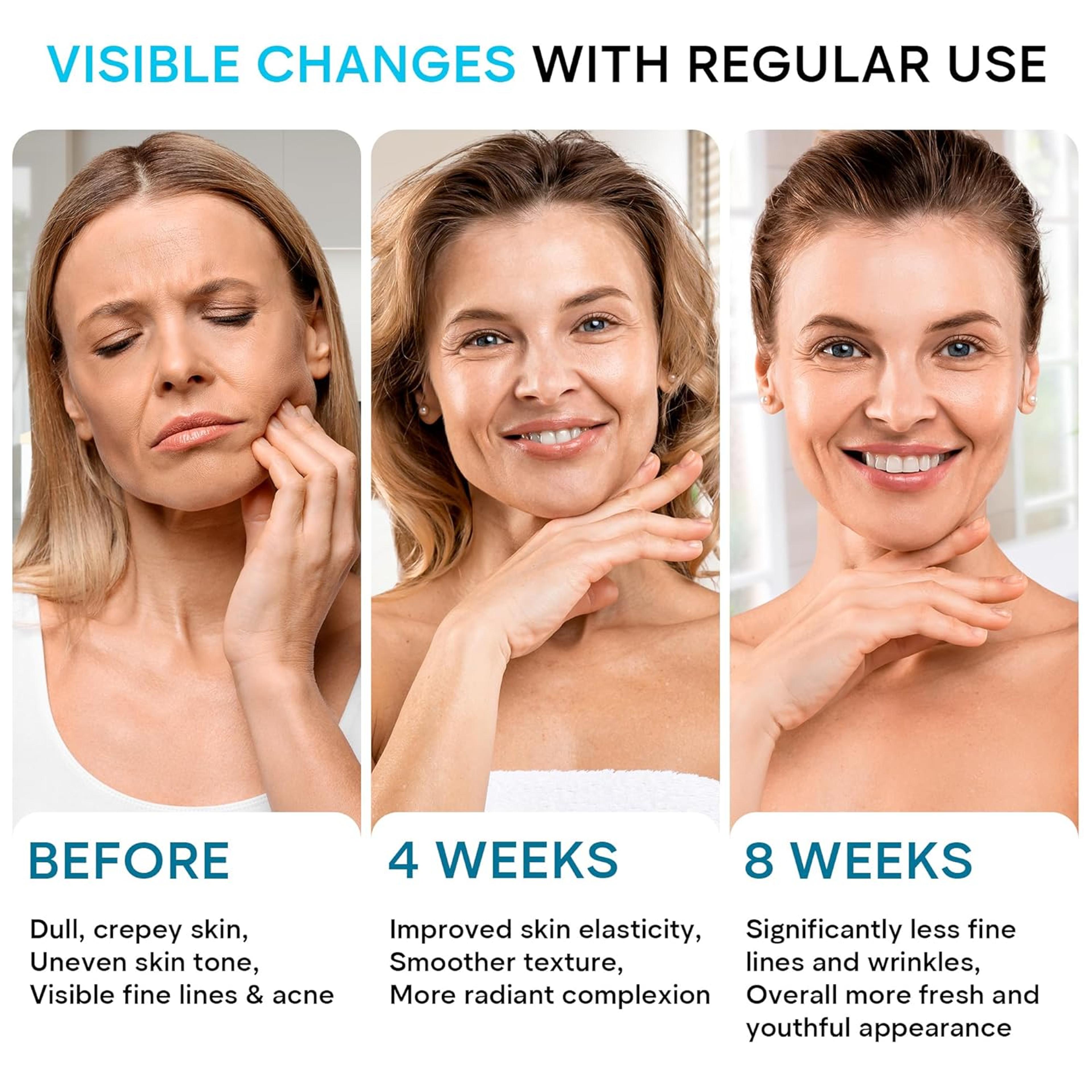 retinol moisturizing cream