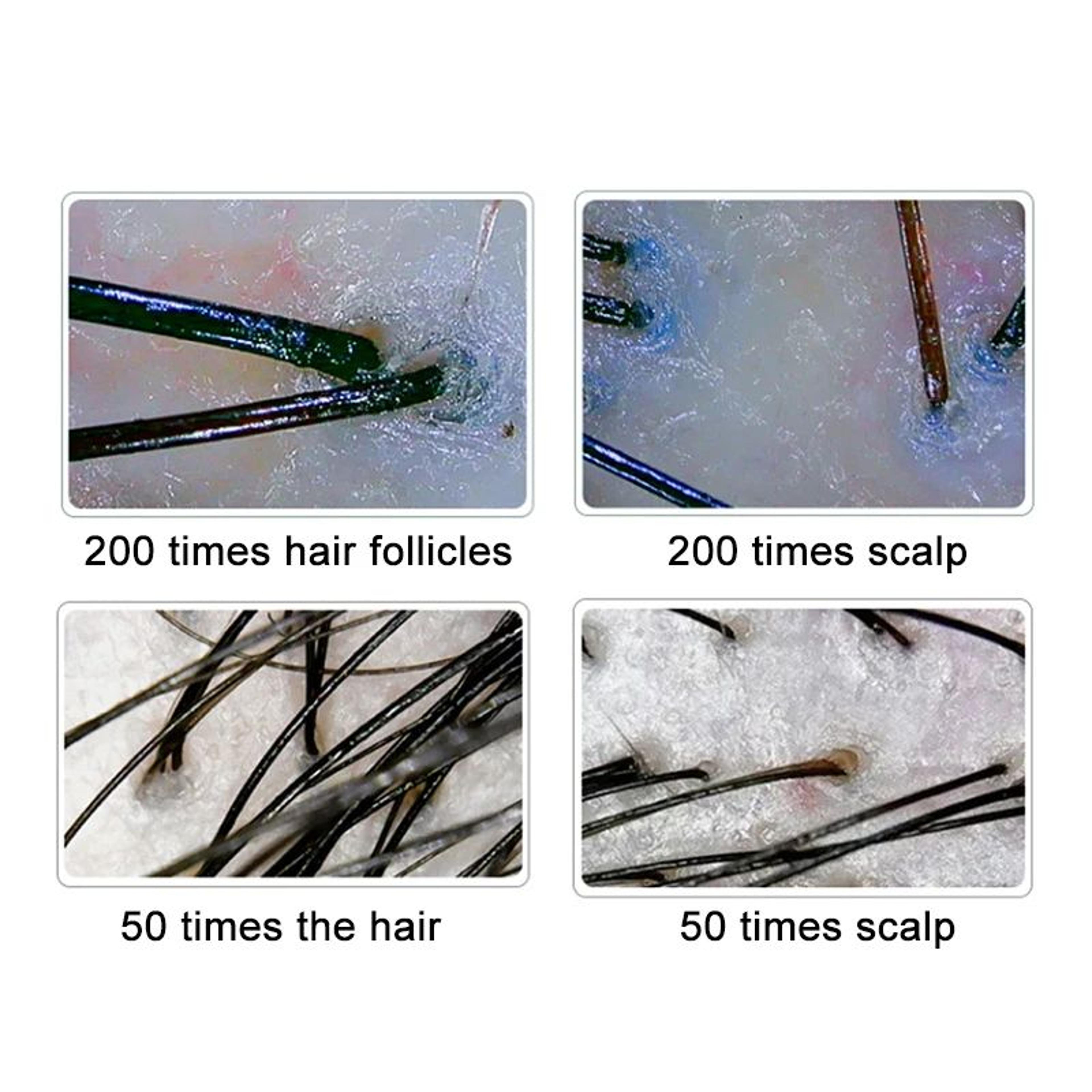 Advanced LCD Scalp Detector Digital Hair Skin Analyzer With DualLens Microscope For Hair Follicle T 1