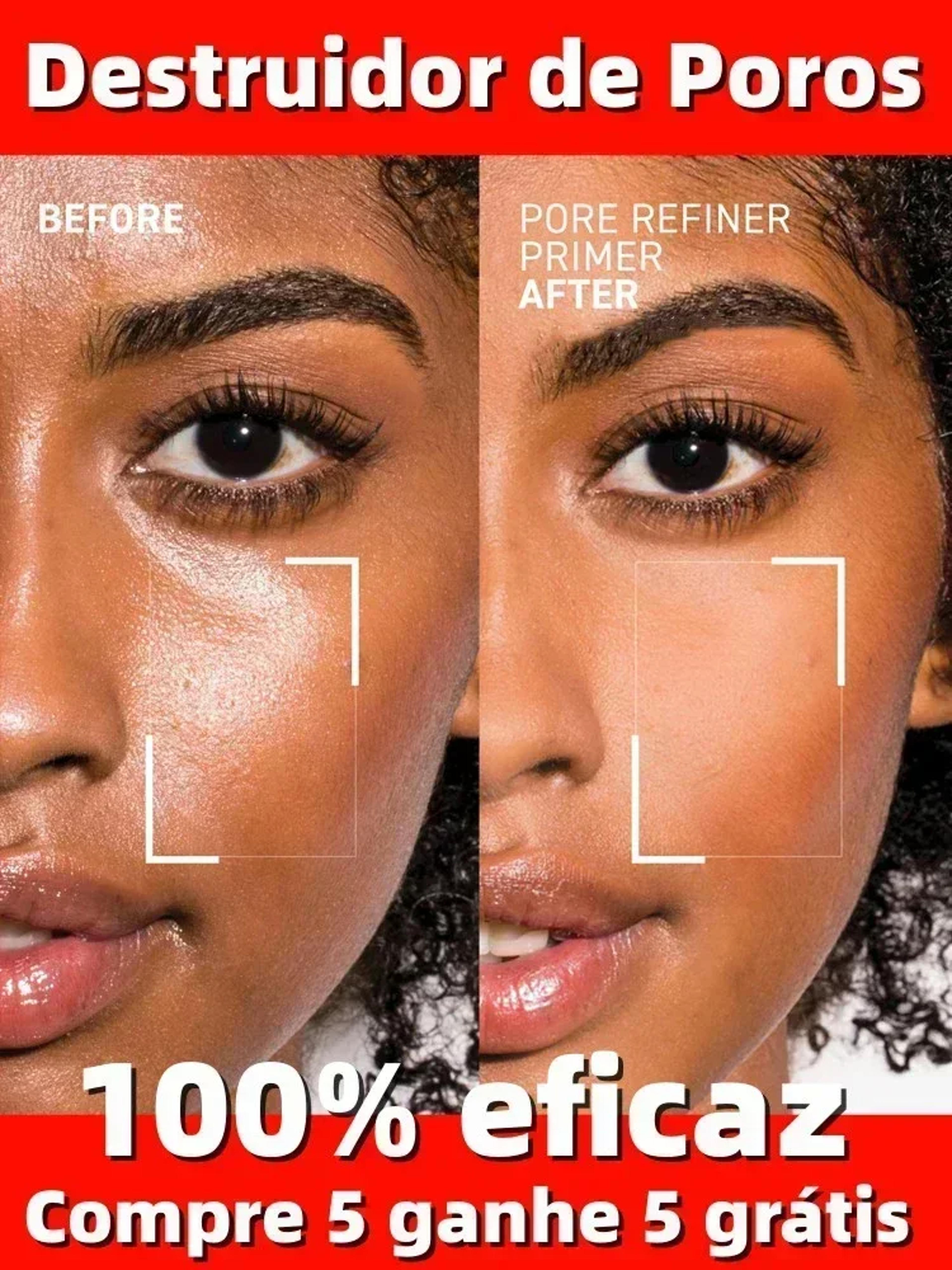 Pore Refining Face Serum For Blackheads And Oil Control With Moisturizing Care 2