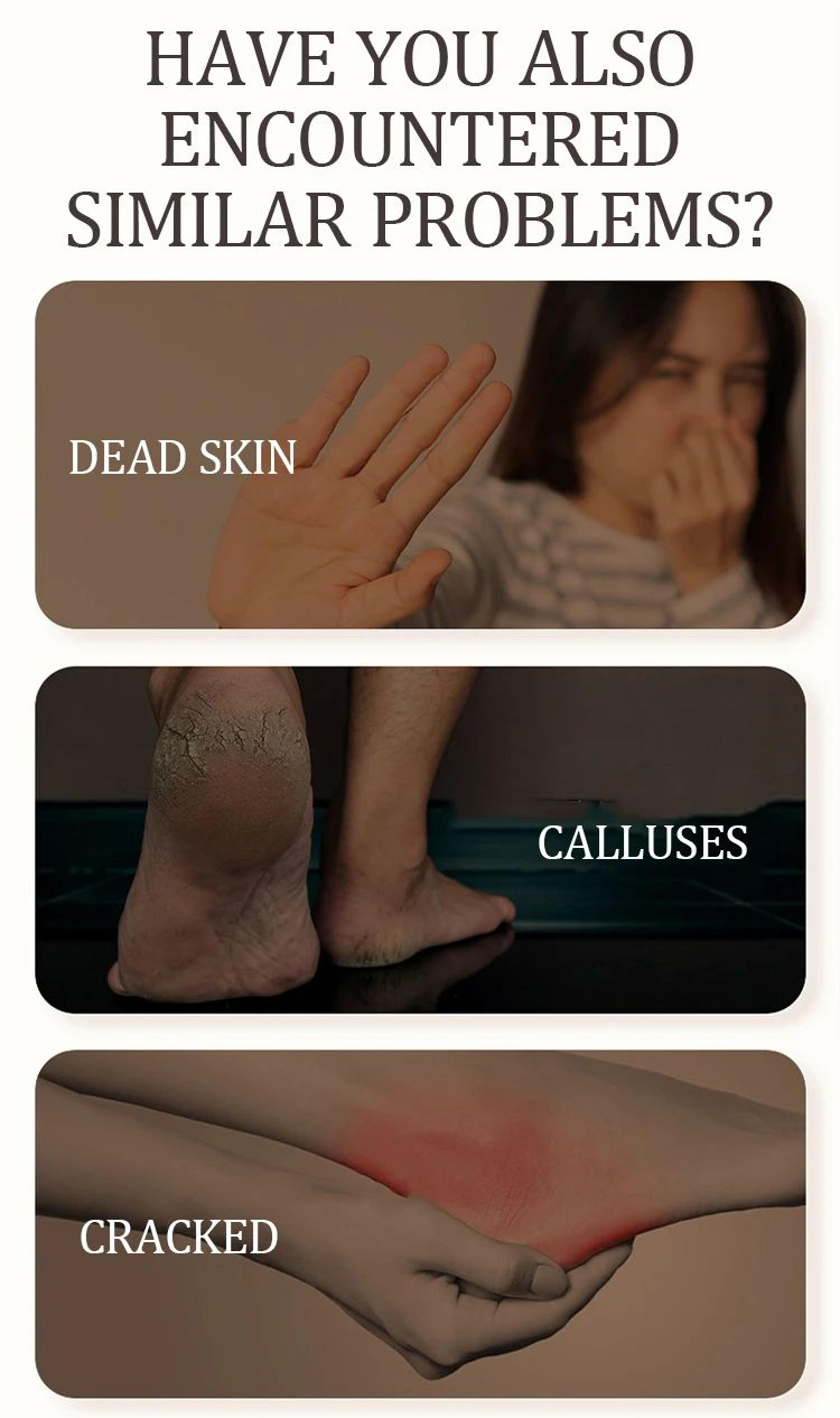 Electric Foot File Callus Remover  Digital Display Foot Grinder For Dead Skin  Cracked Heels  Pedic 8