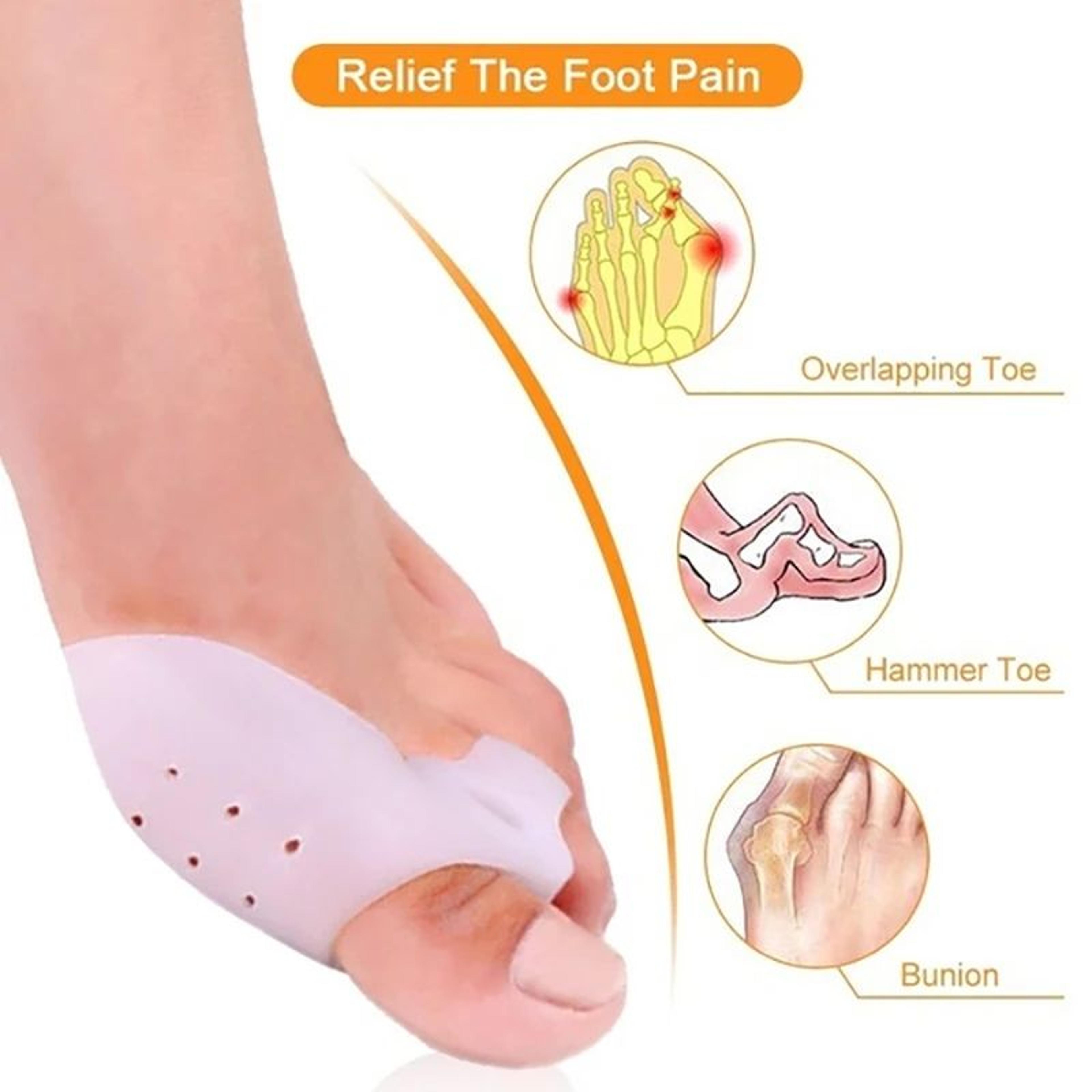 AlignEase Silicone Toe Corrector  Hallux Valgus Separator 1 Pair 2