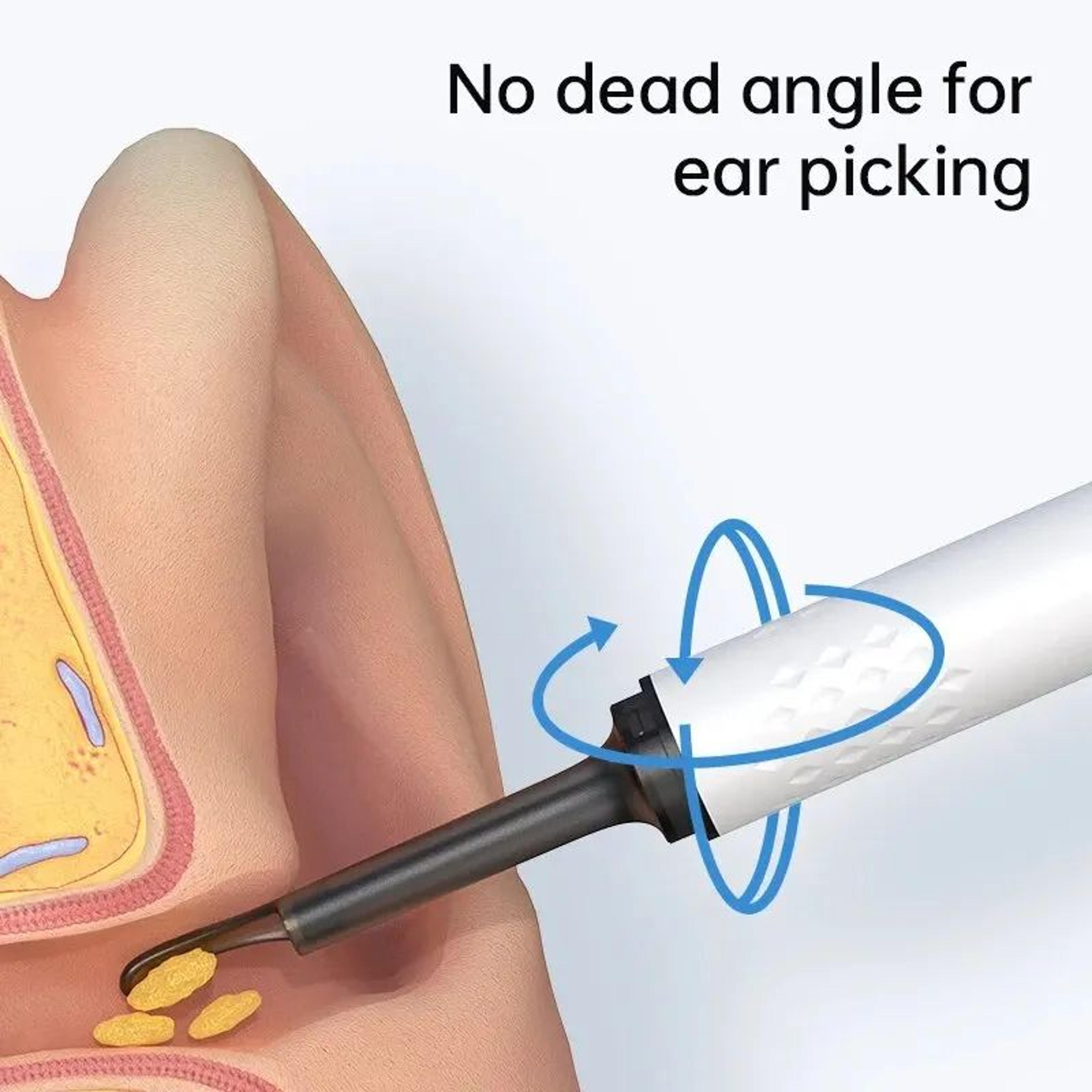 ClearView WiFi Ear Cleaner Camera  HD Otoscope Ear Wax Removal Tool With LED Lights 1