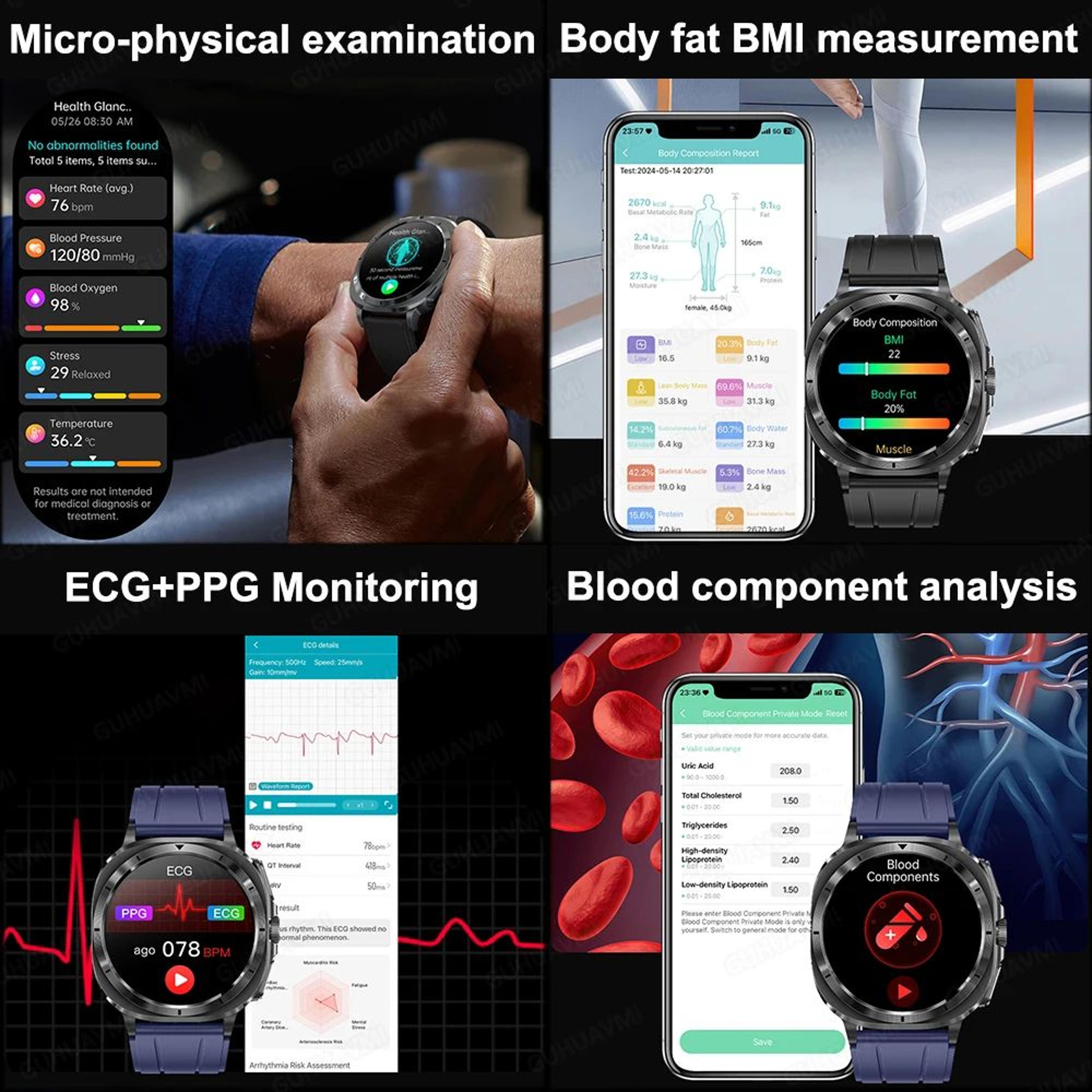 2025 ECG Health Smart Watch  AMOLED Bluetooth Call Fitness Tracker With Body Analysis 2