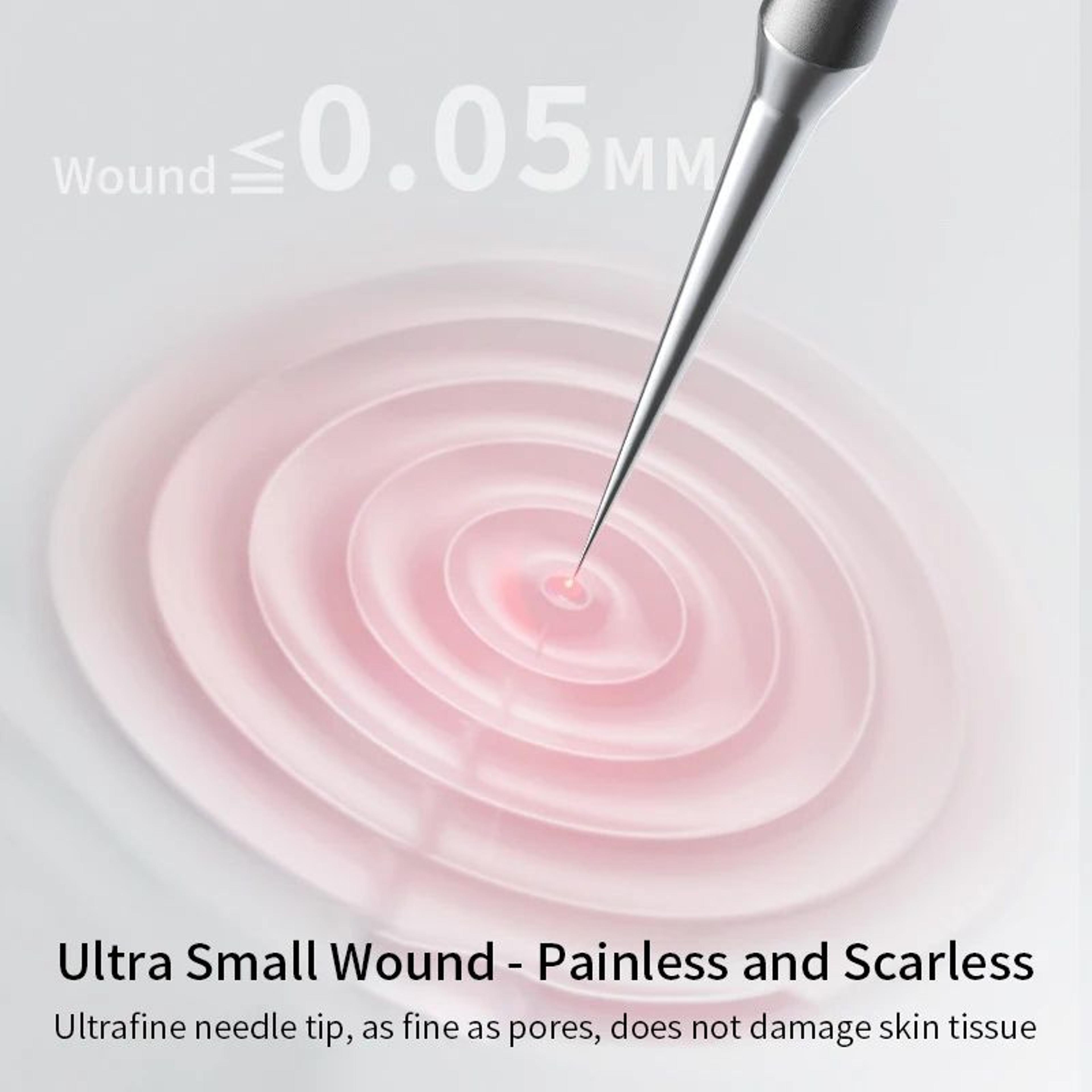 German UltraFine Blackhead  Acne Extractor Tool  Stainless Steel Pimple Whitehead  Milia Remover Fo 4