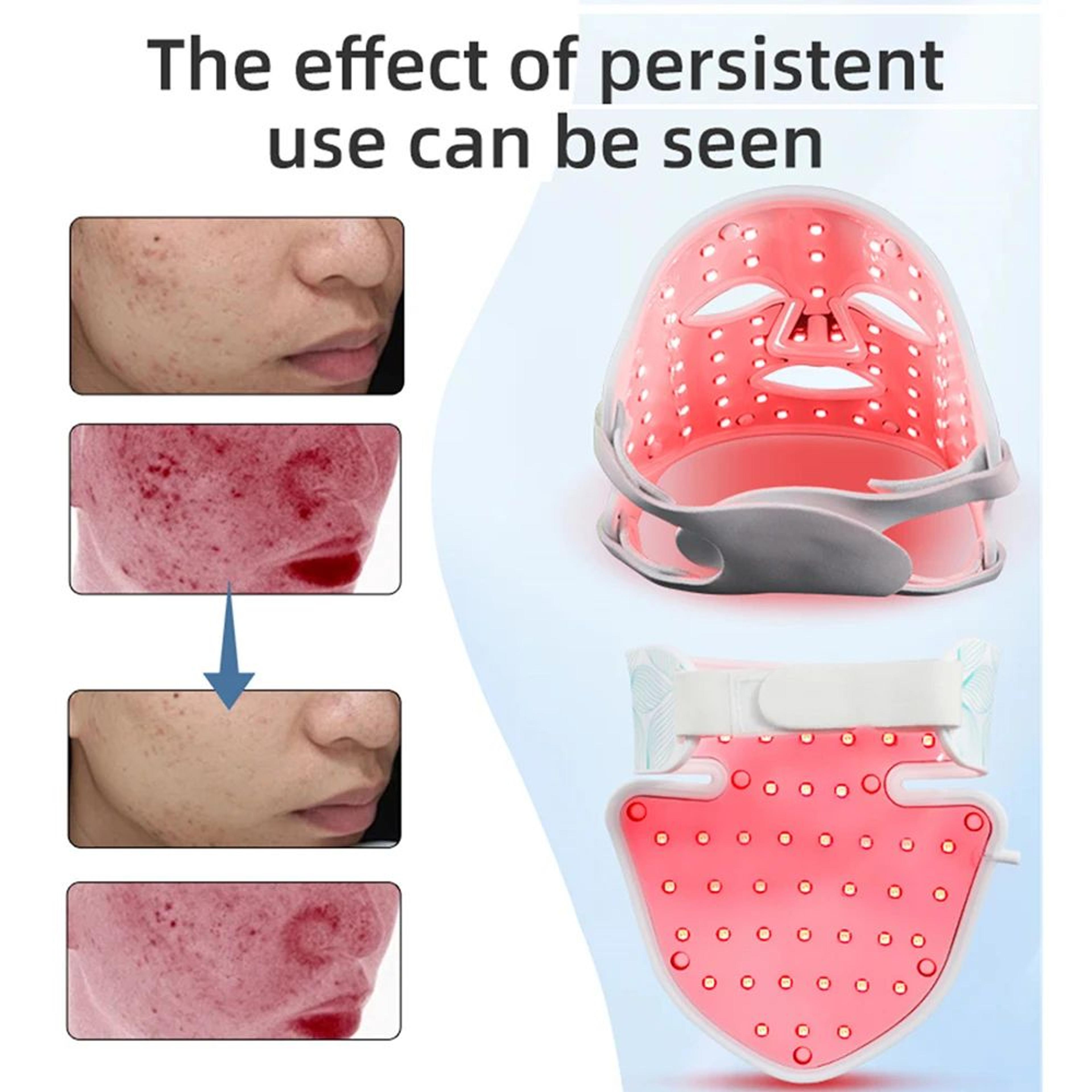 Silicone LED Face  Neck Mask  8 Color Red Light Therapy Mask For AntiAging Acne Care  Skin Rejuvena 3