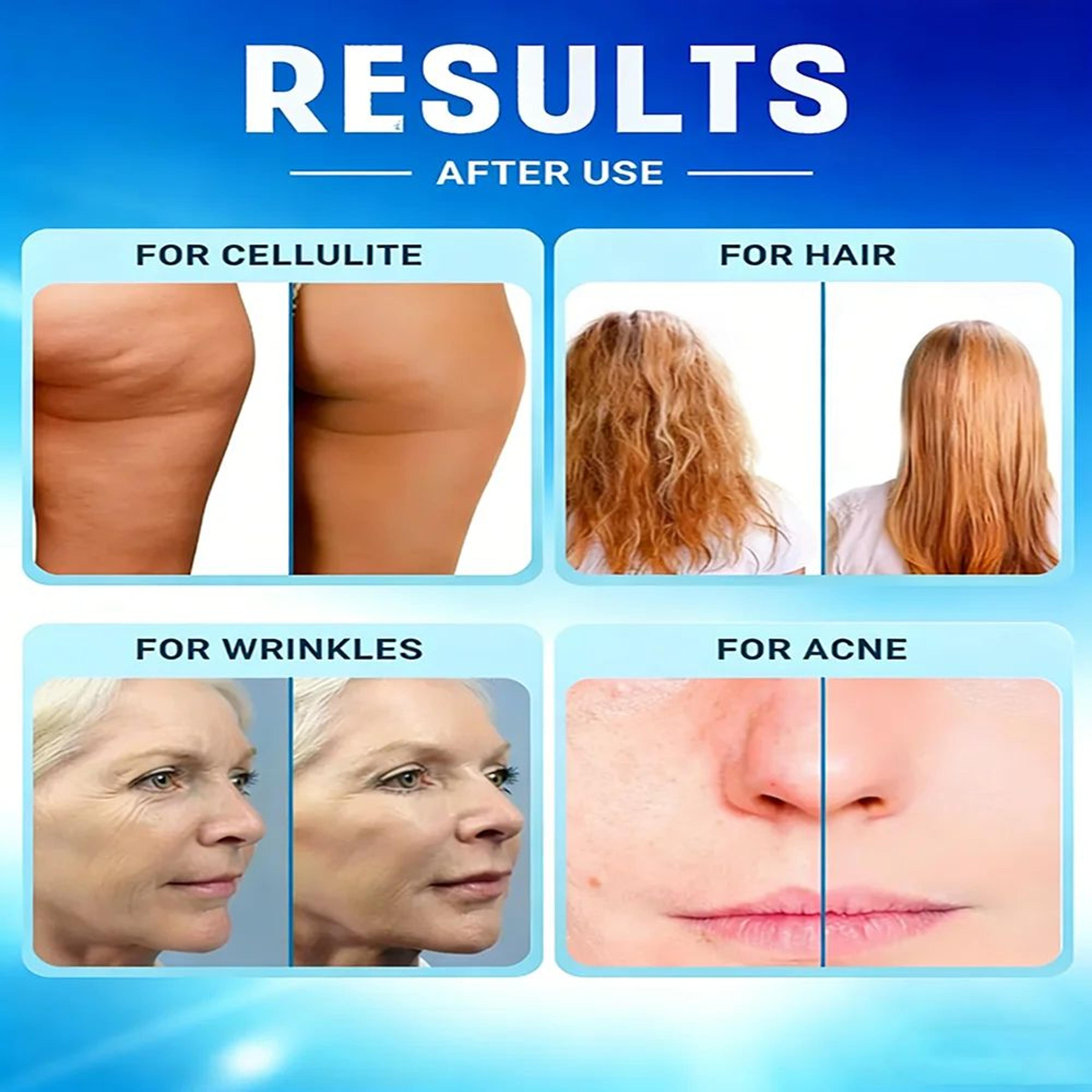 4 In 1 High Frequency Facial Wand With Glass Electrodes  Electrotherapy Acne Spot Skin Tightening M