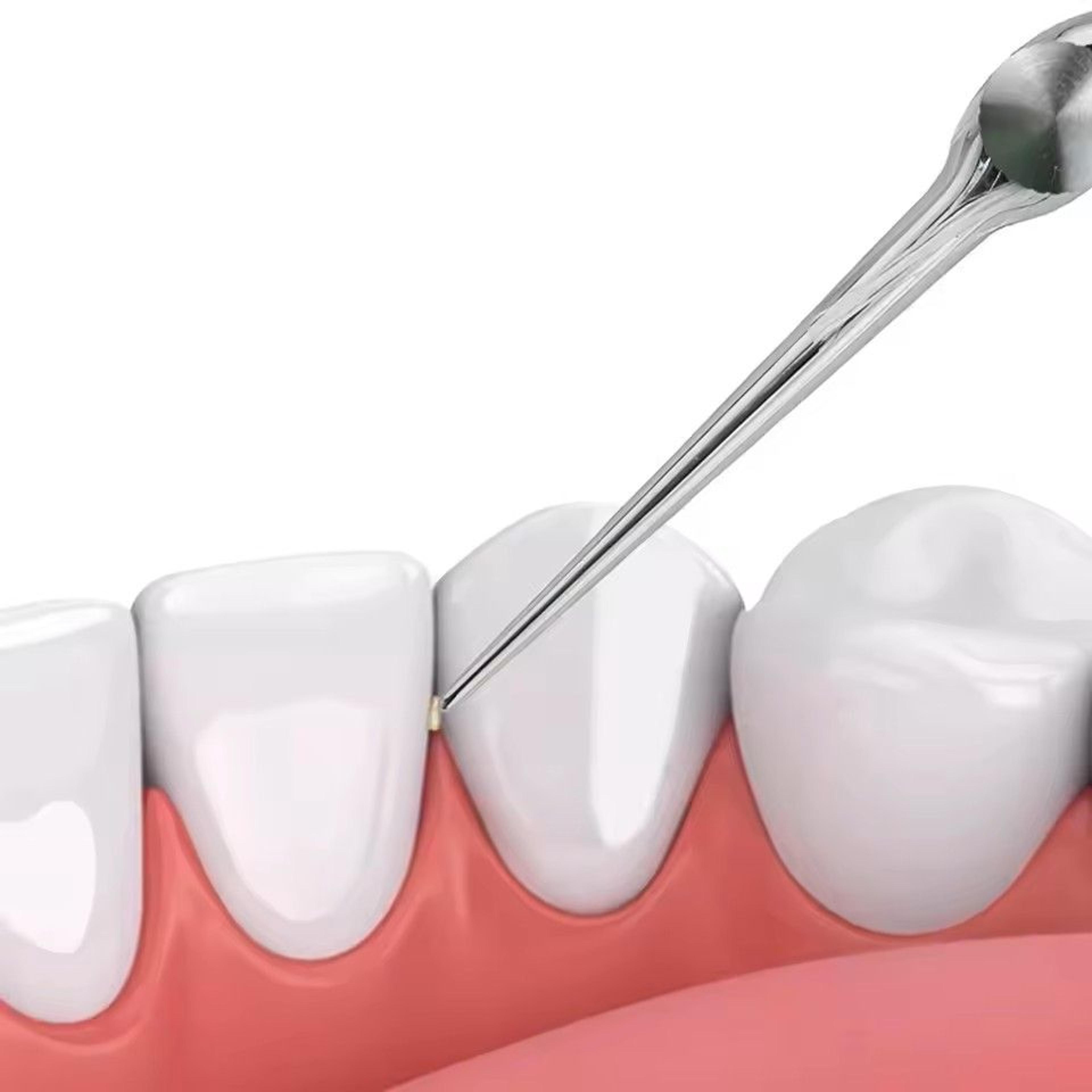 Stainless Steel Toothpick And Reusable Y Shape Flossing Holder Portable Eco Friendly Teeth Cleaning 2