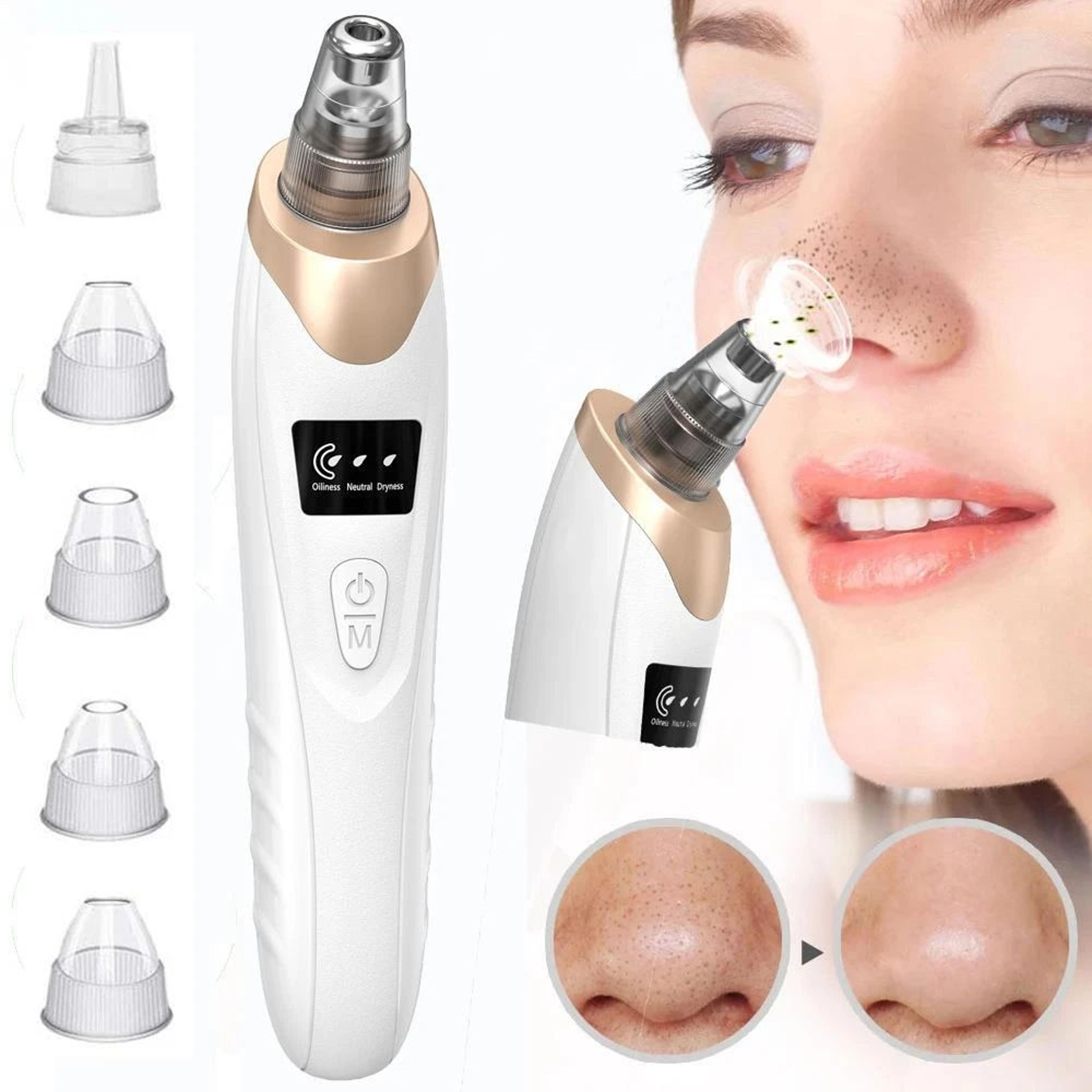 Electric Facial Blackhead Vacuum Cleaner 0