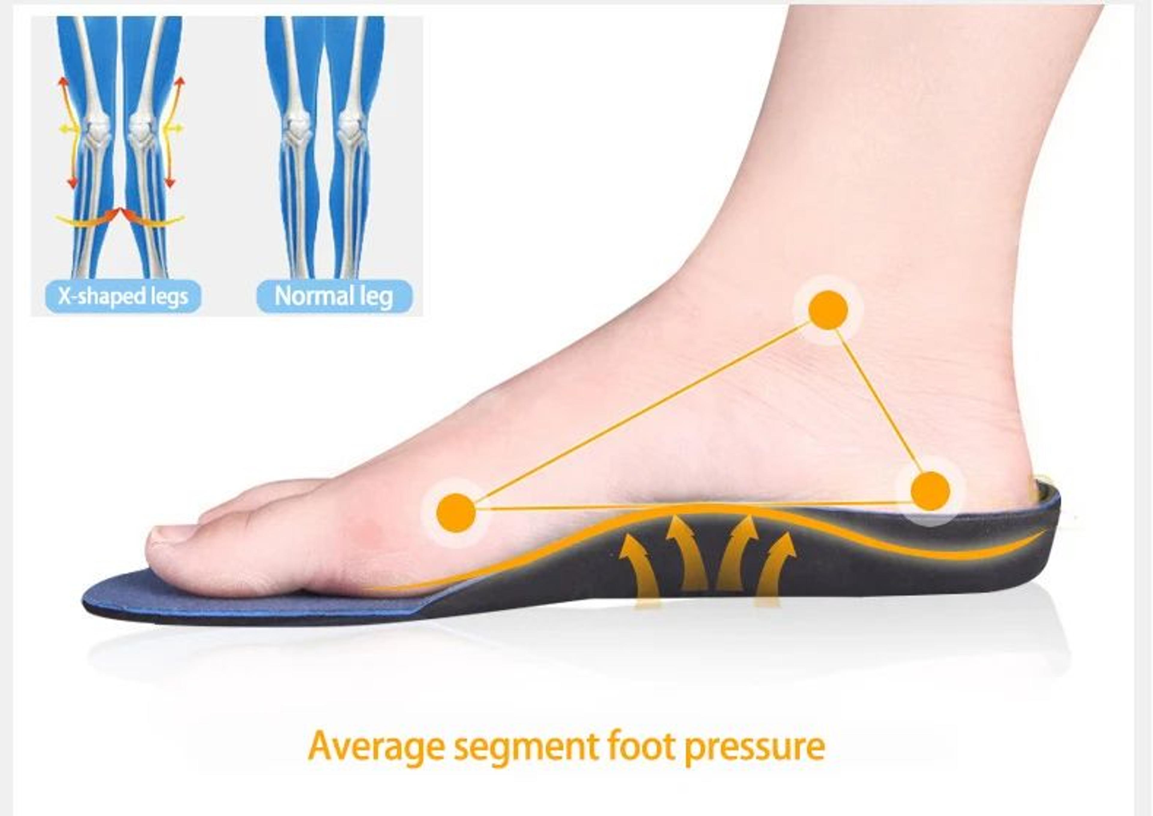 Arch Support Orthopedic Insoles 8