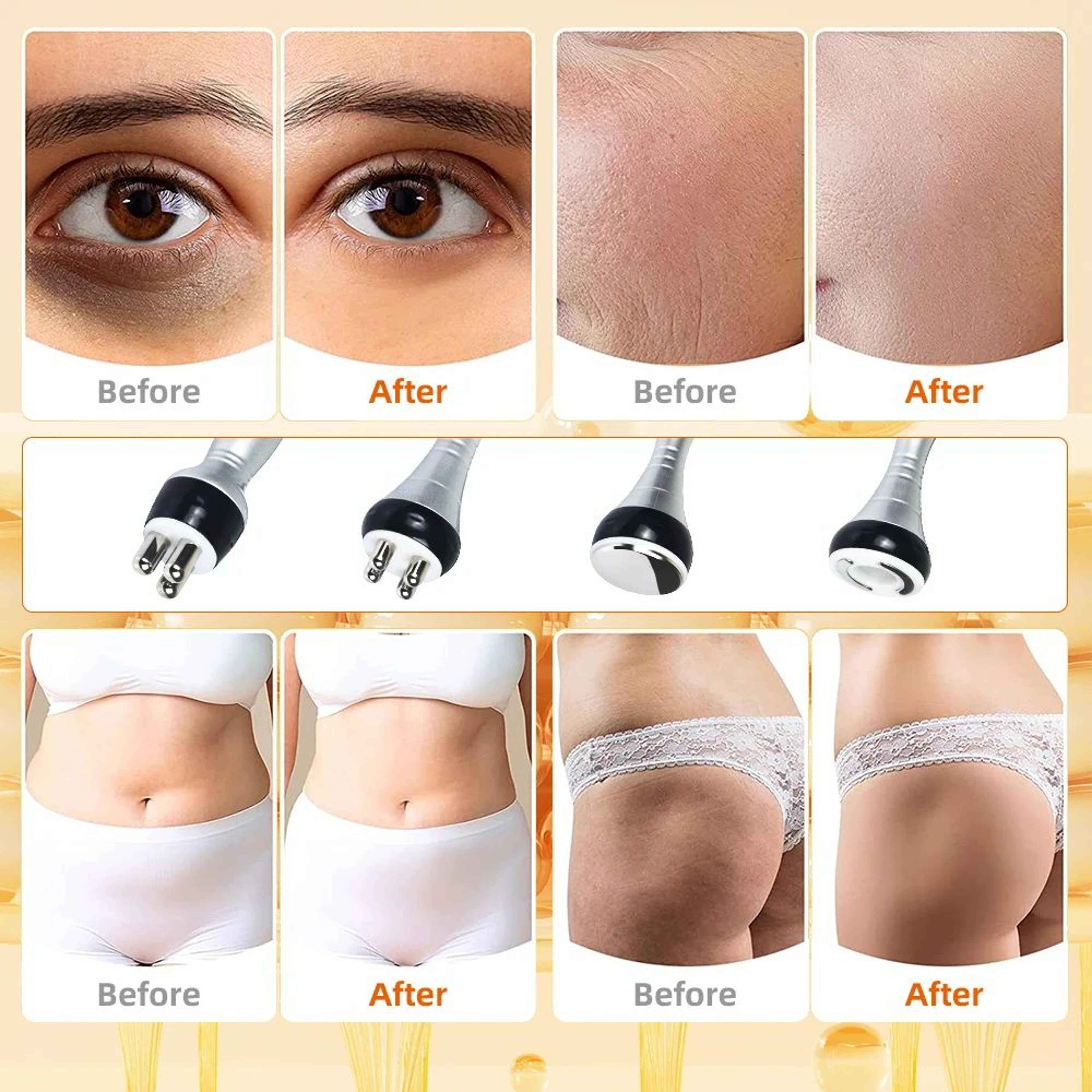 4in1 40K Cavitation Body Slimming  Skin Tightening Machine 9
