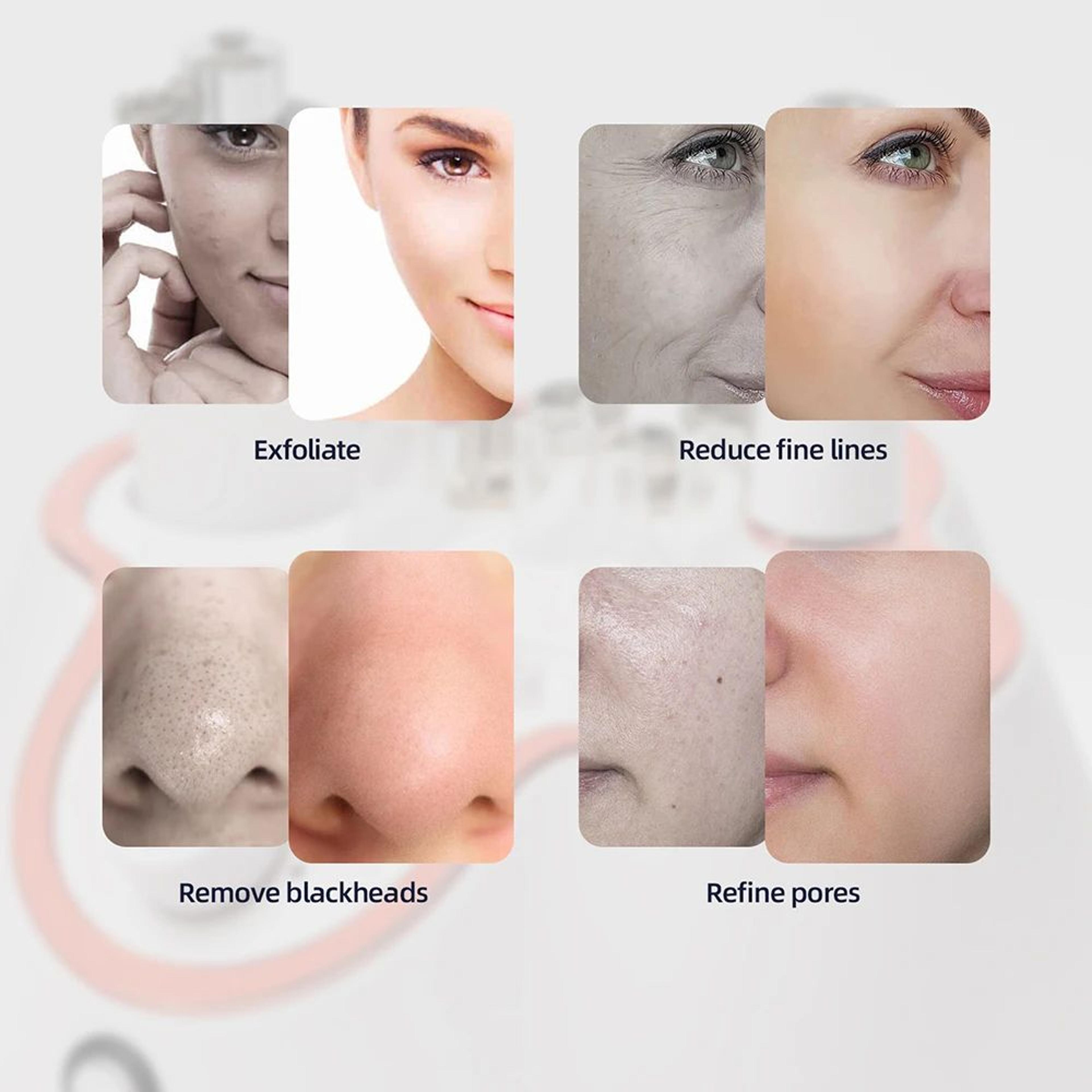 Professional Diamond Microdermabrasion Machine For Deep Facial Cleaning 11
