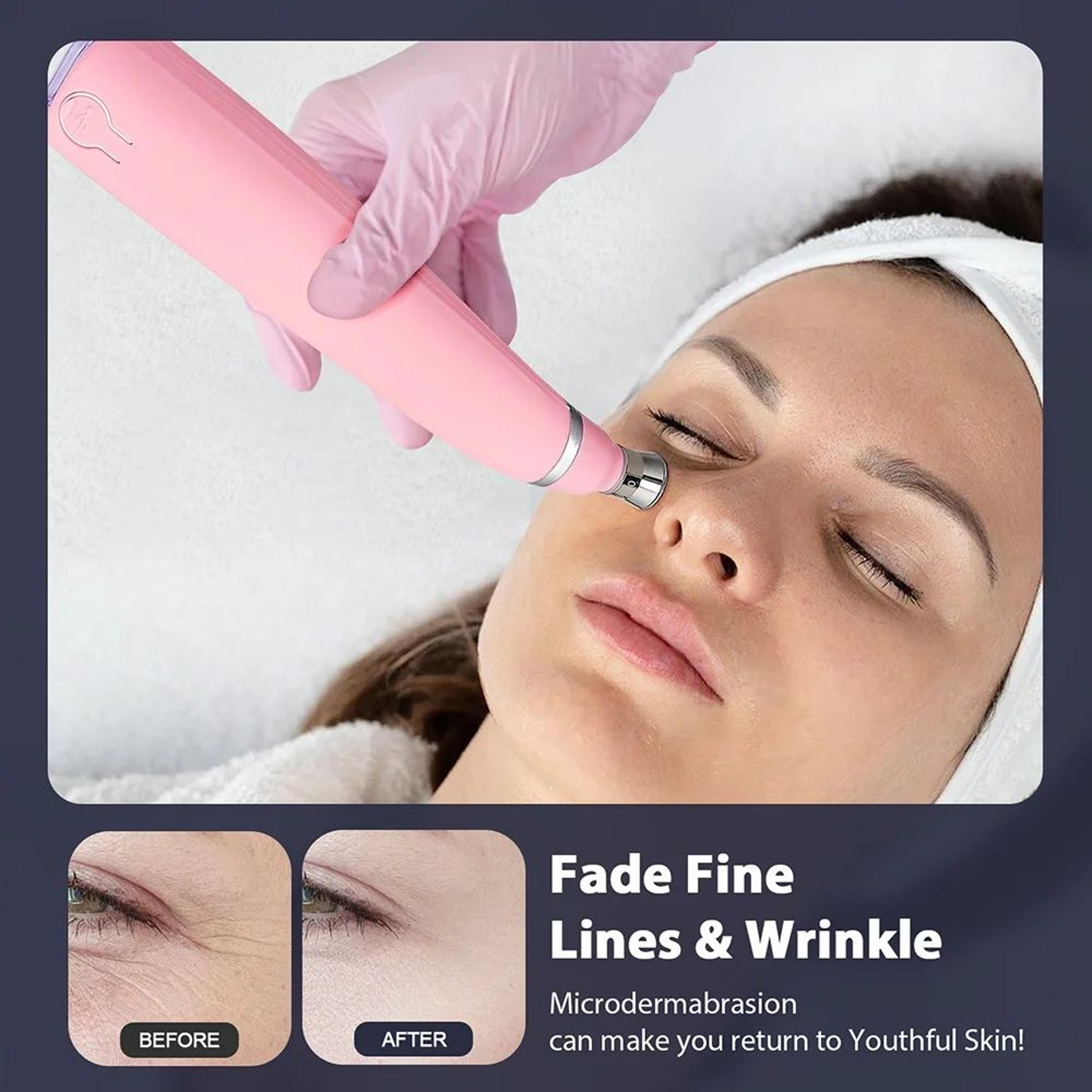 Professional Diamond Microdermabrasion Machine For Deep Facial Cleaning 17