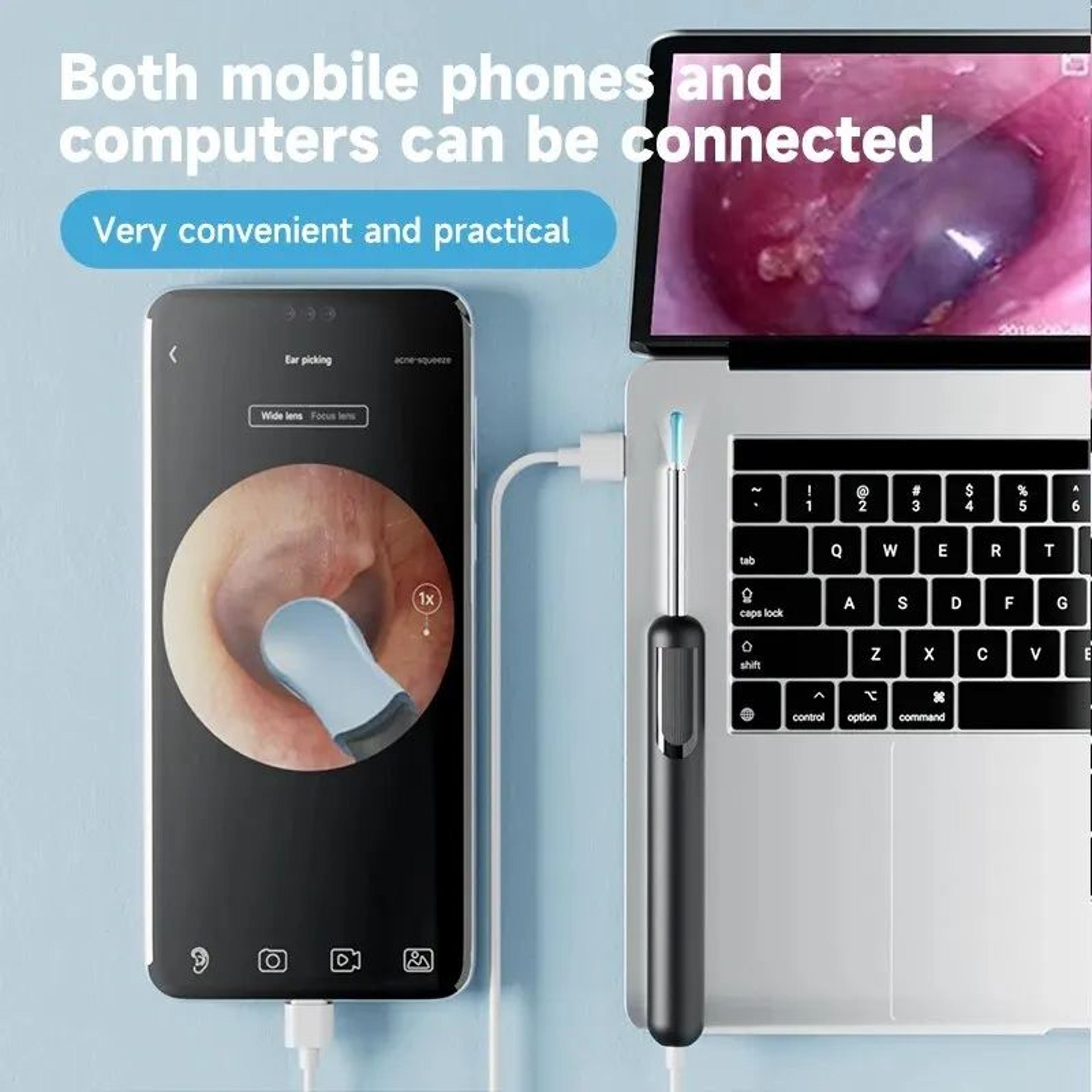 Smart Ear Wax Removal Camera Tool 3