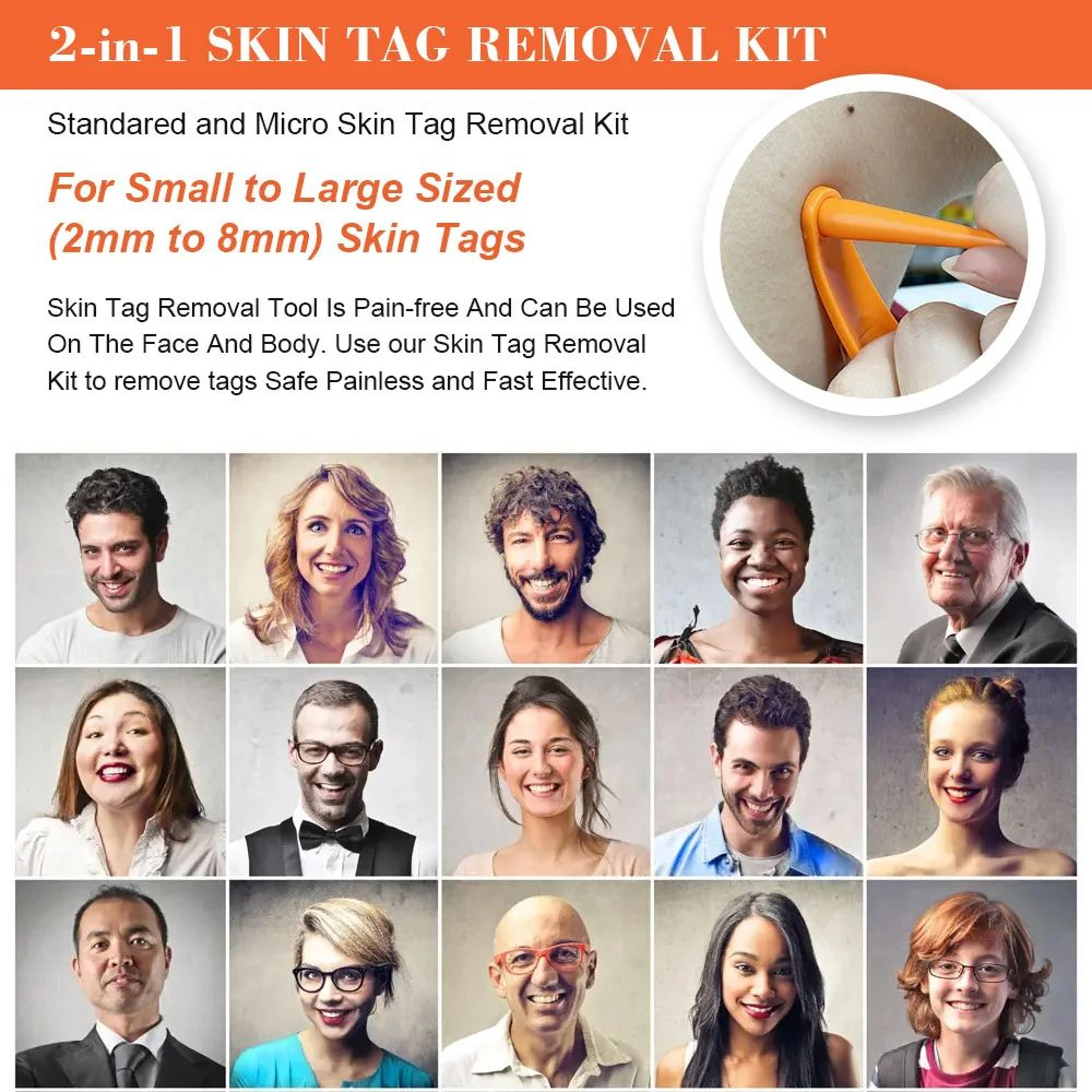 2 In 1 Electric Skin Tag Removal Pen Kit 3