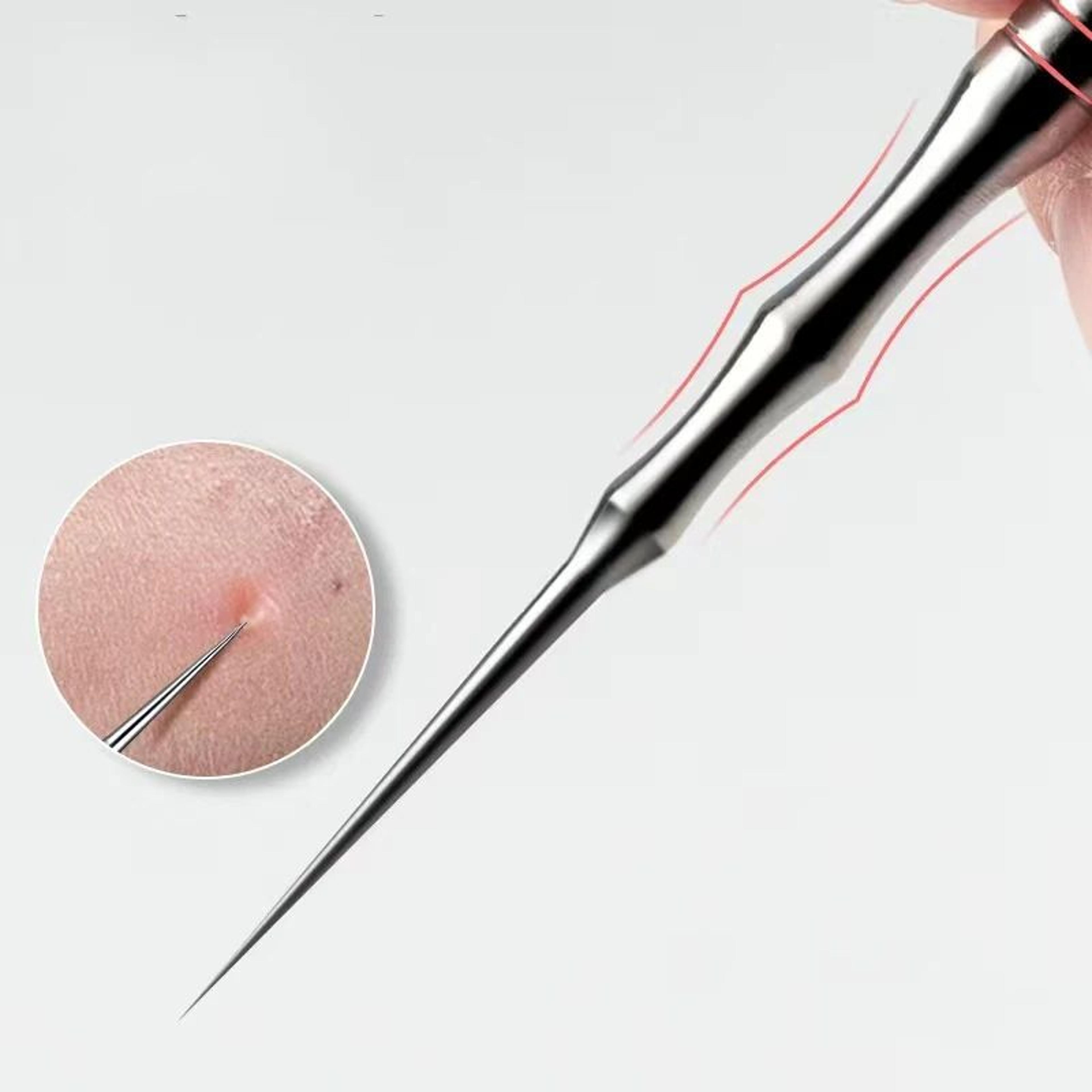 ultra fine stainless steel blackhead removal tweezers