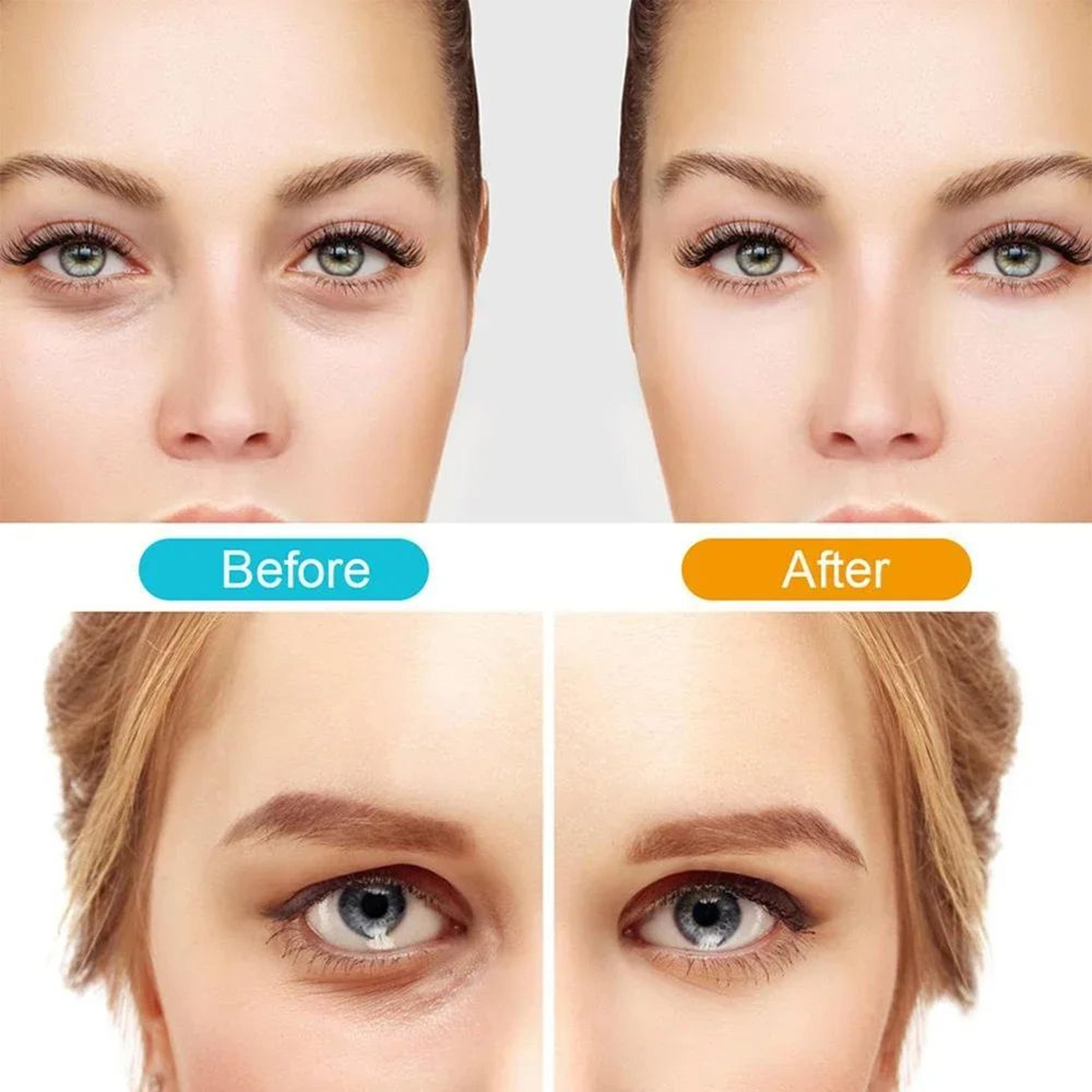 3D Electric Eye Massager For Dark Circles And Eye Care 7