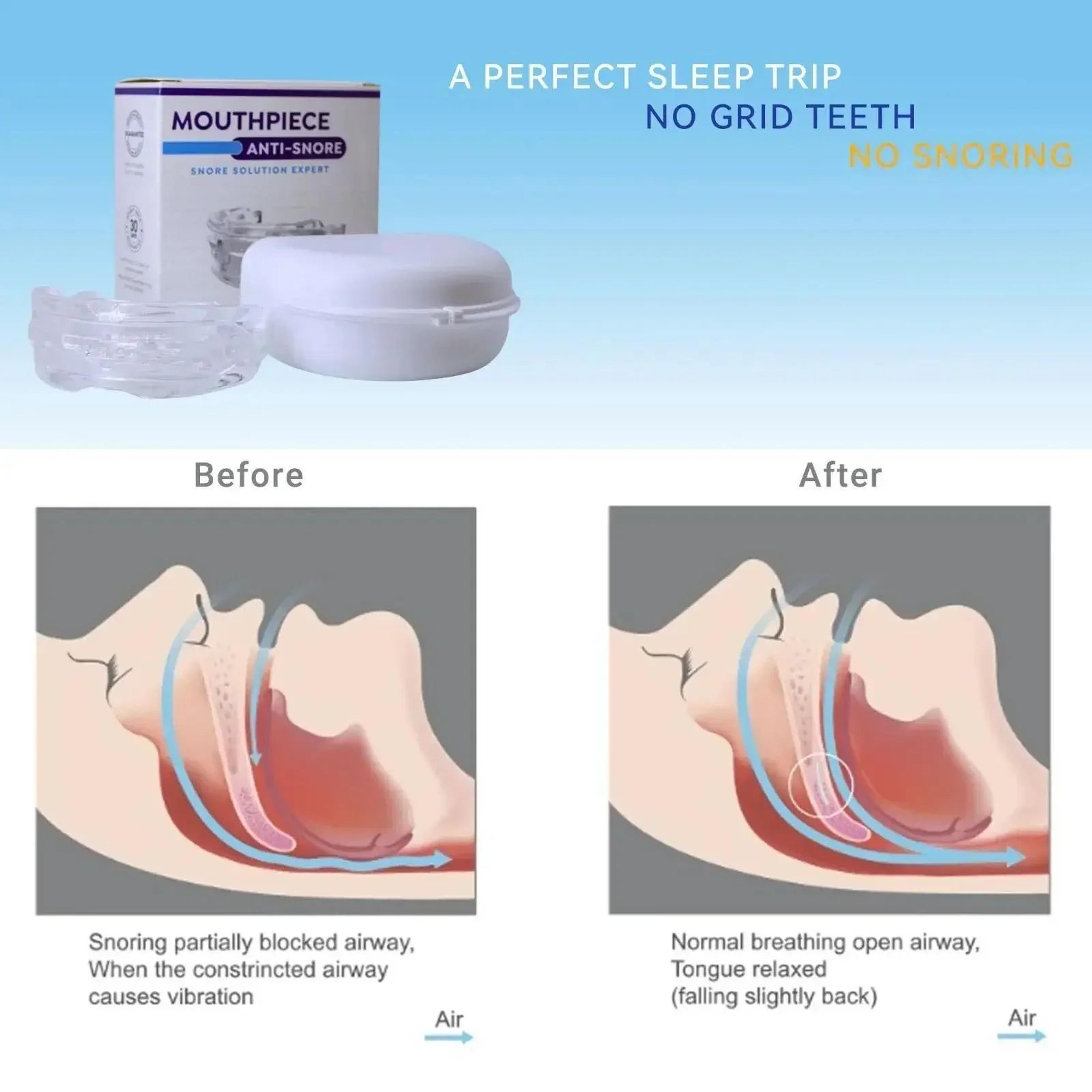 AdjustFit AntiSnore  Bruxism Mouth Guard  Adjustable Night Sleep Mouthpiece 3