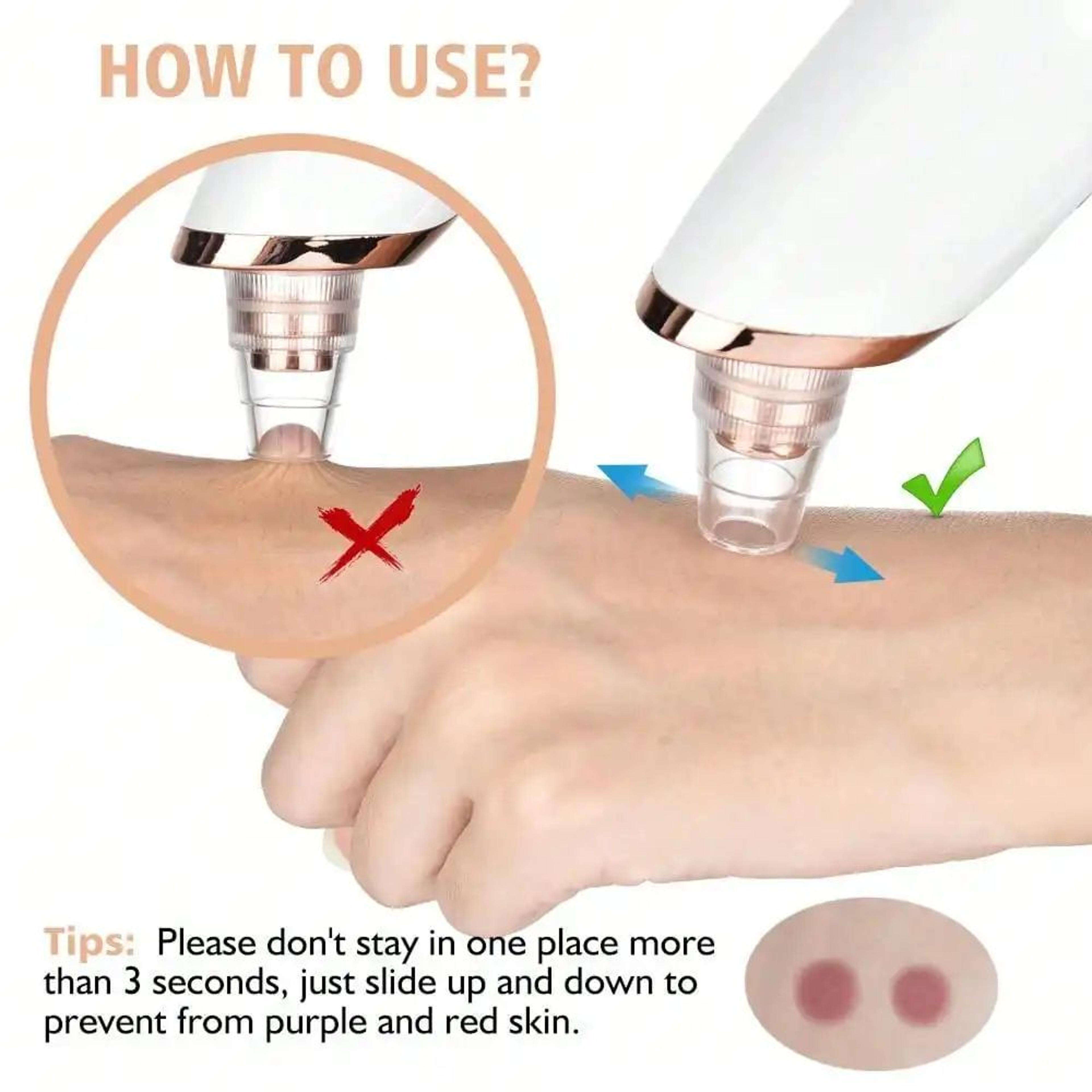 RadiantClear Pro Pore Vacuum Blackhead Remover 3