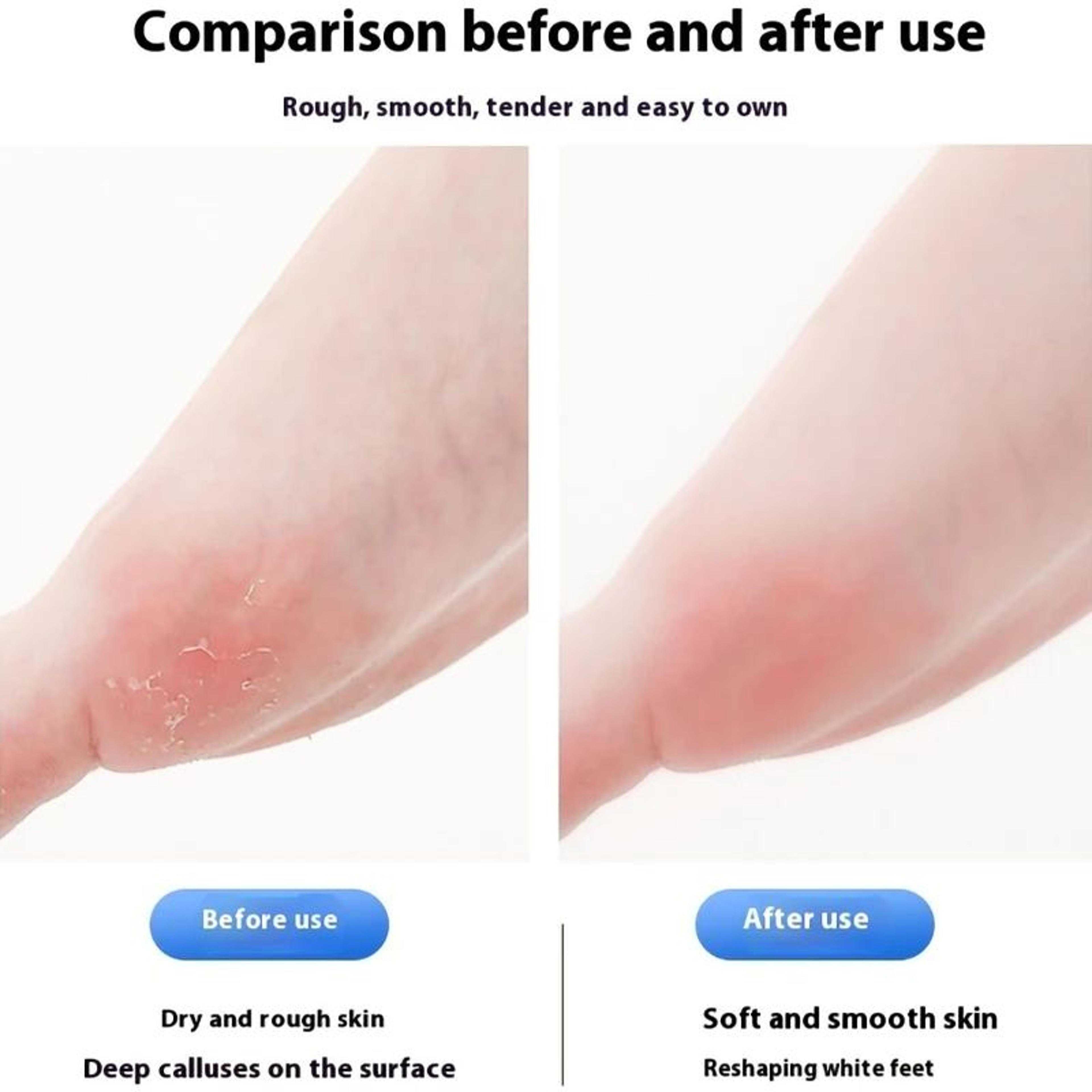 SmoothStep Electric Foot File Rechargeable Callus Remover For Dry Cracked Feet 2