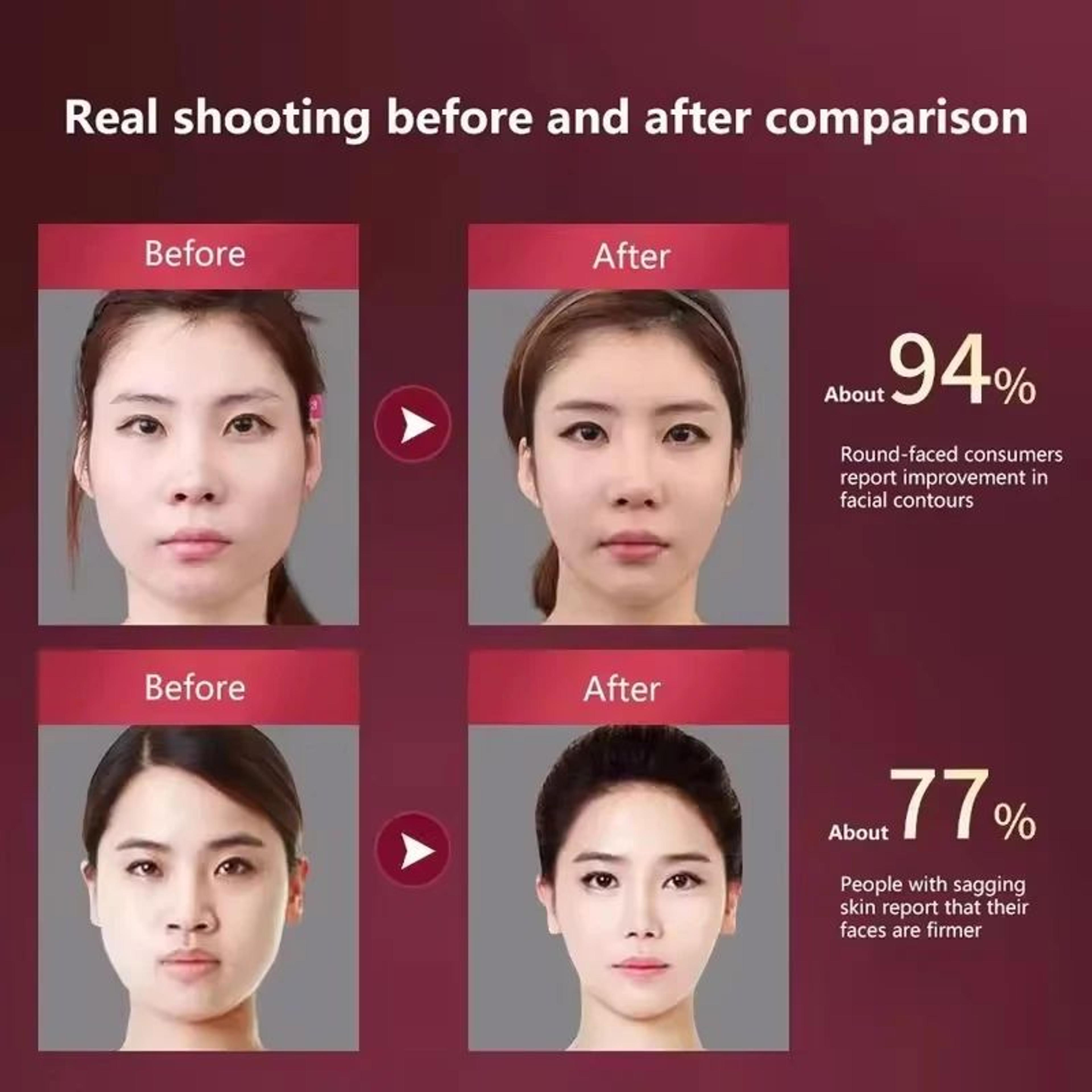 RadianceLift LED Face Massager V Face Lifting Device With Heat And Vibration 5