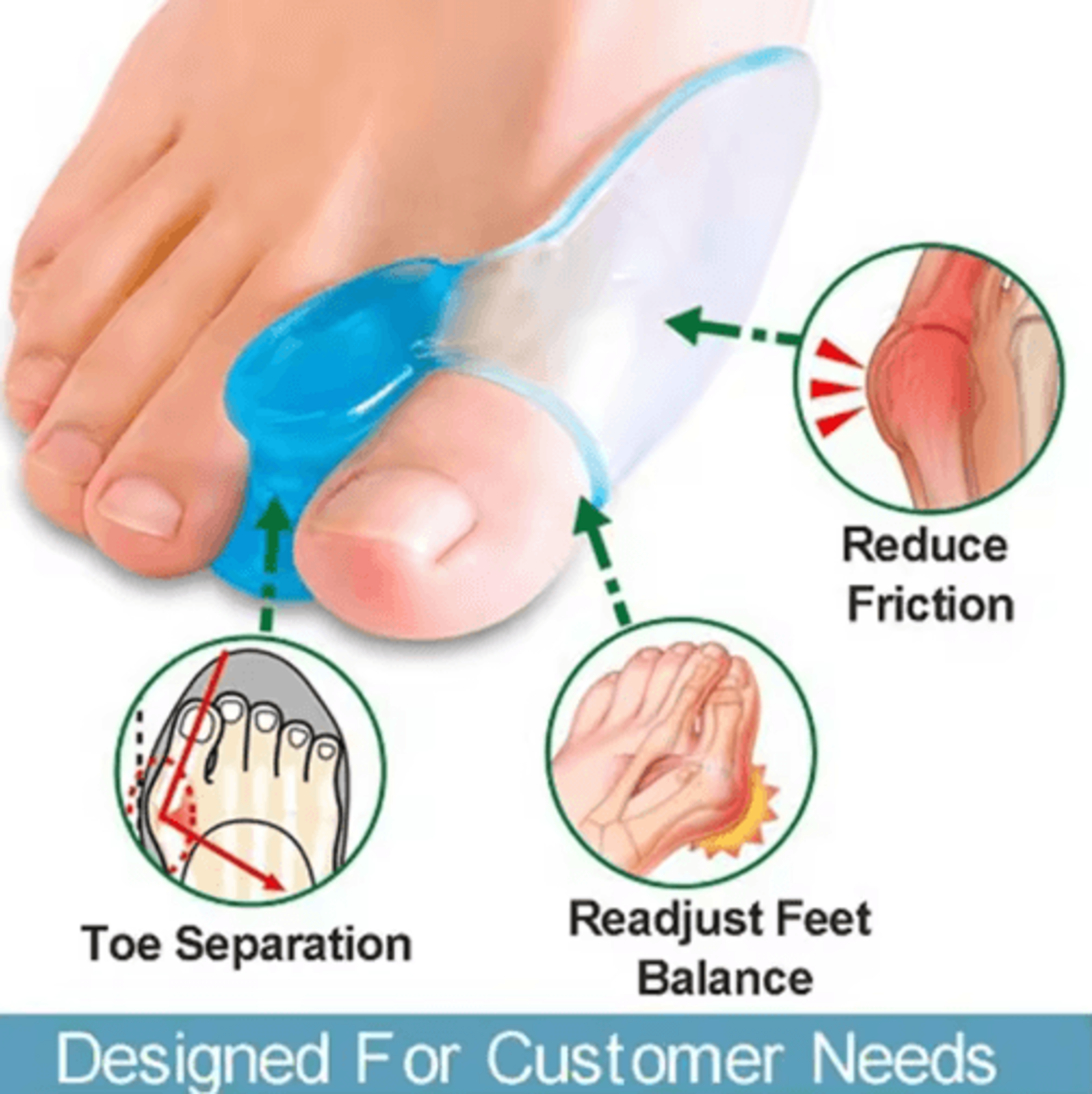2-piece silicone toe splitter hallux valgus alignment & toe separation sleeves