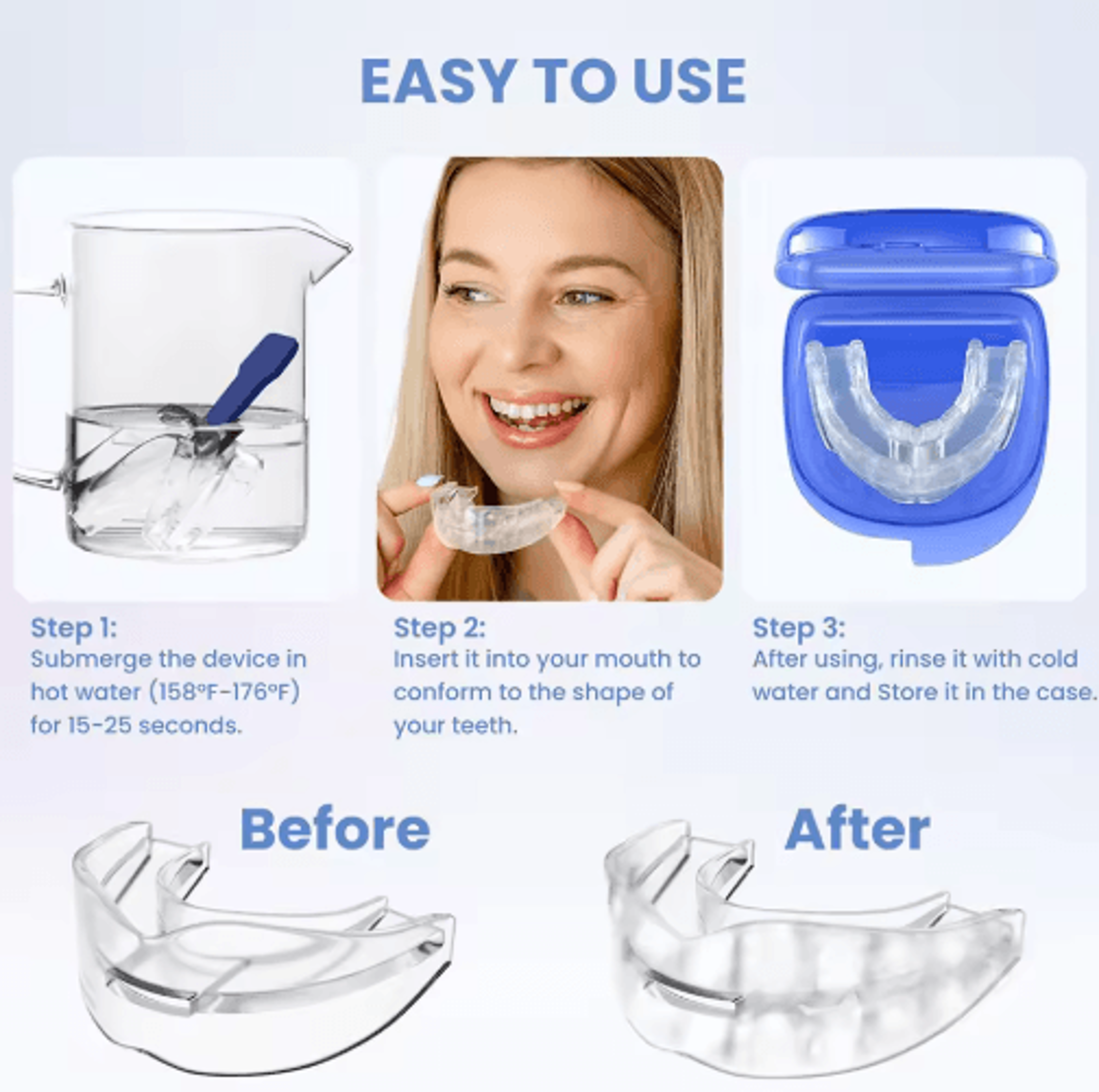 AntiSnoring Bruxism Mouth Guard  Night Guard For Teeth Grinding  Sleep Comfort 4
