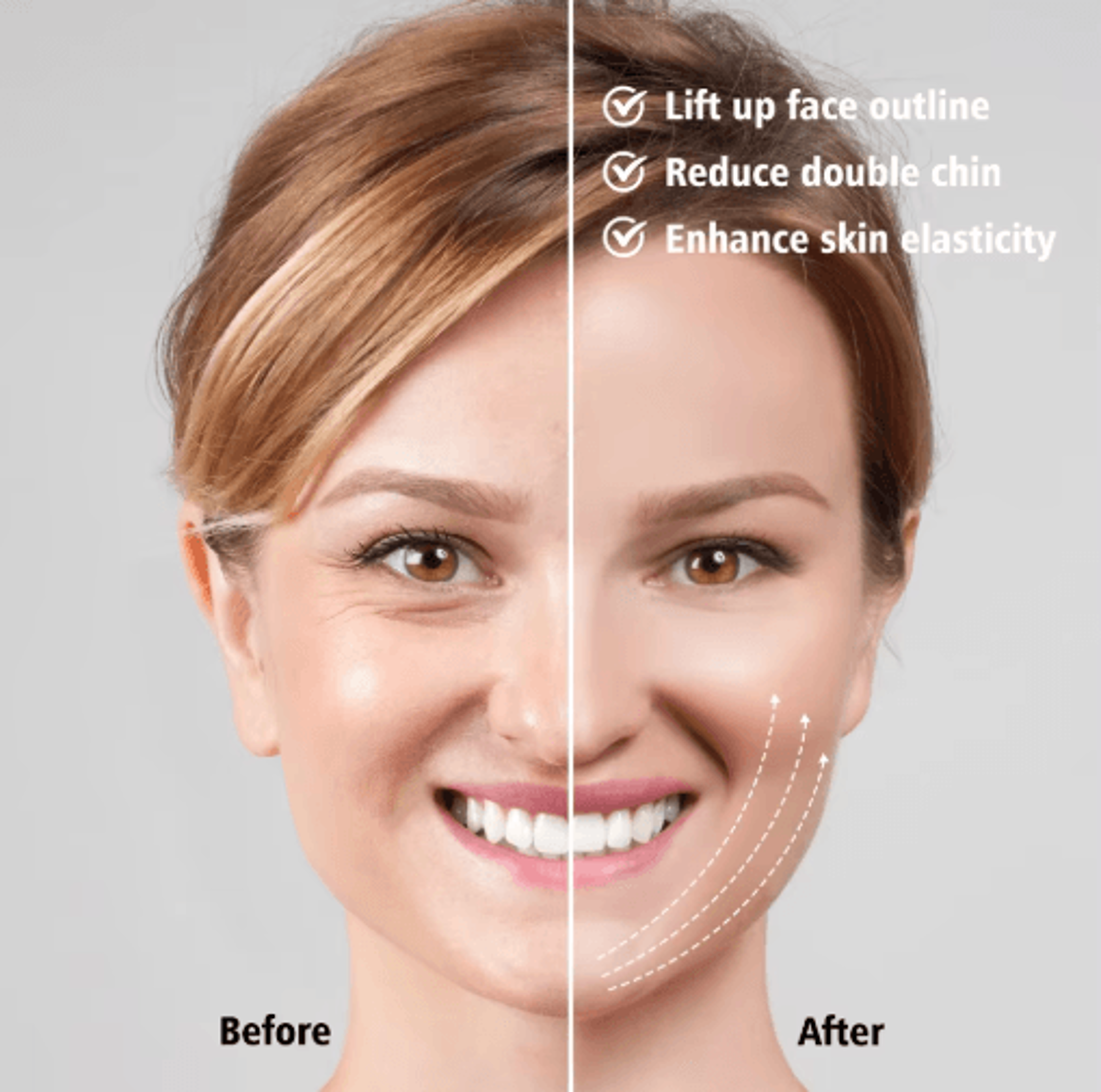 EMS Facial Lifting Massager With Microcurrent For Firming  VFace Care 7