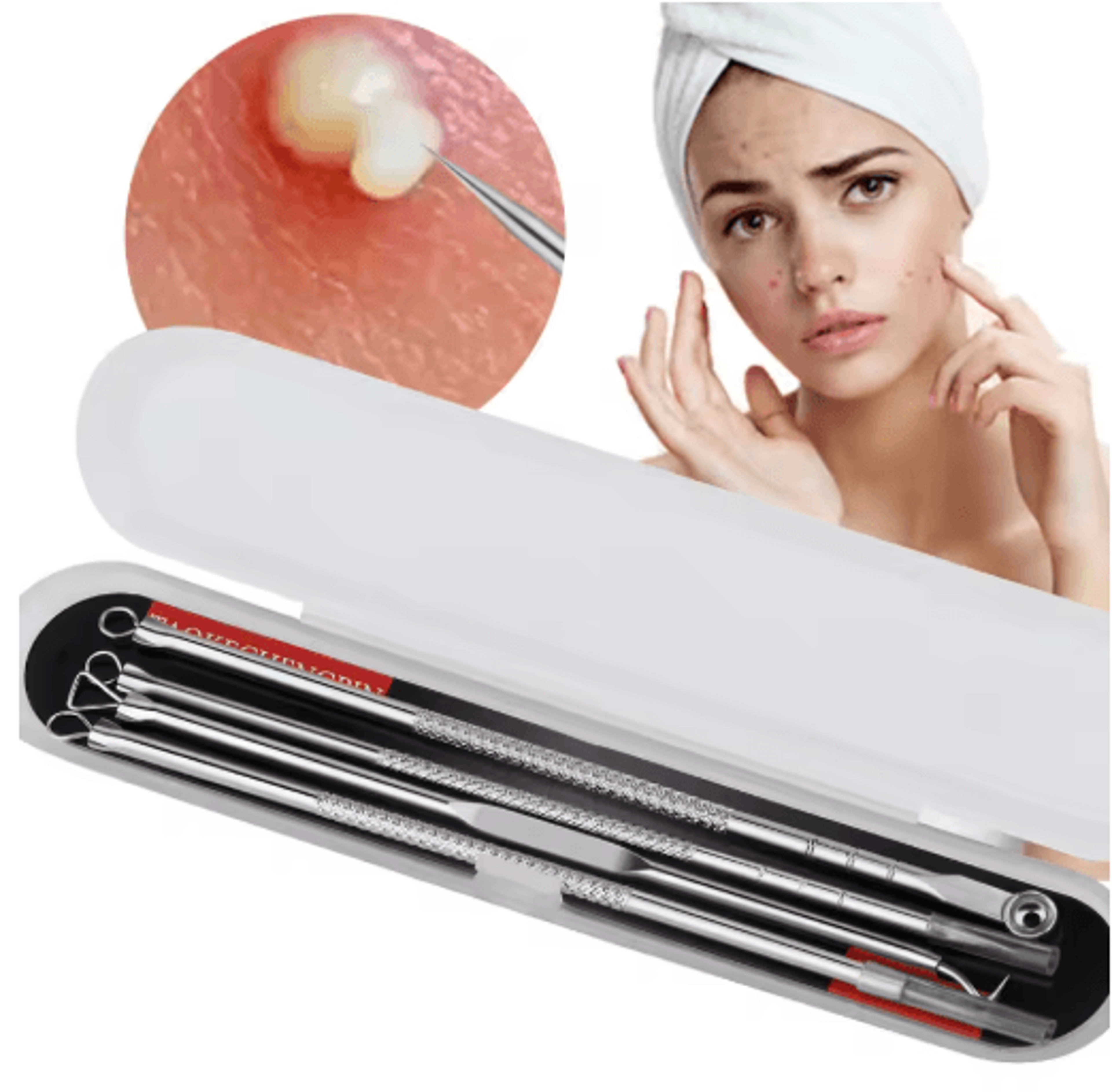 ClearPoint Ultra Fine Blackhead And Pimple Remover Tweezers Set 2