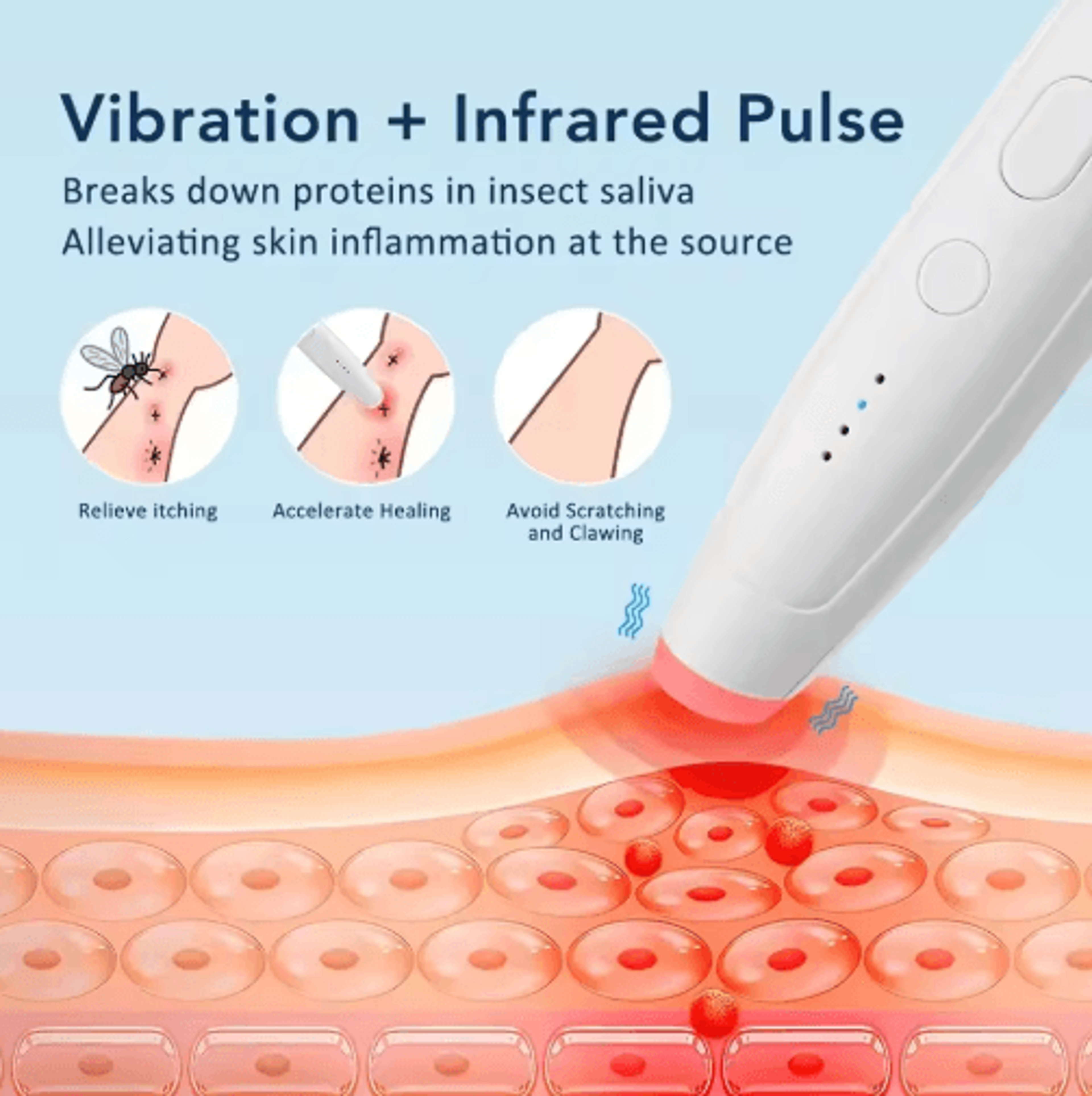Portable Heated AntiItch Pen For Insect Bites 7