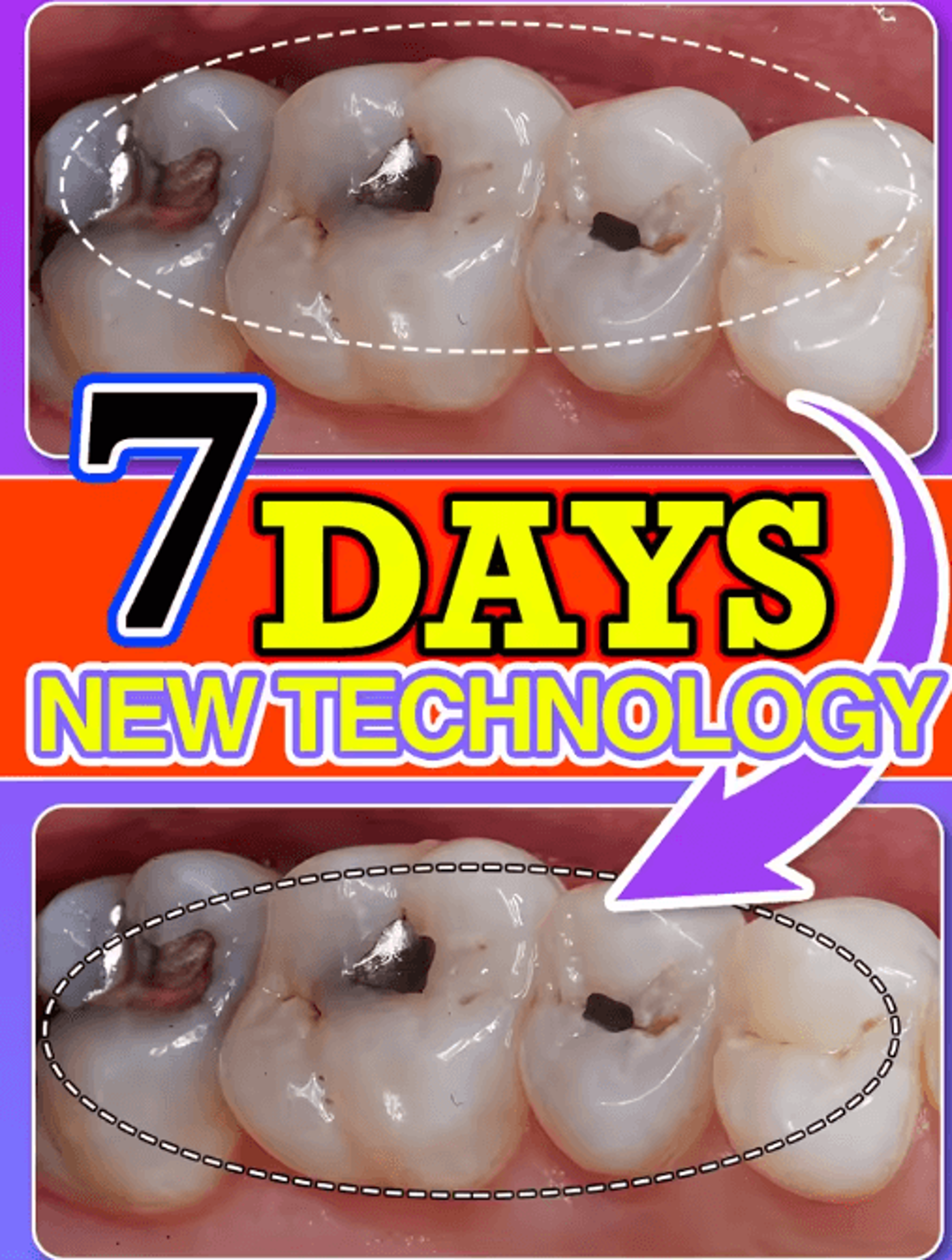 targeted tooth care product – daily cavity & dental care support