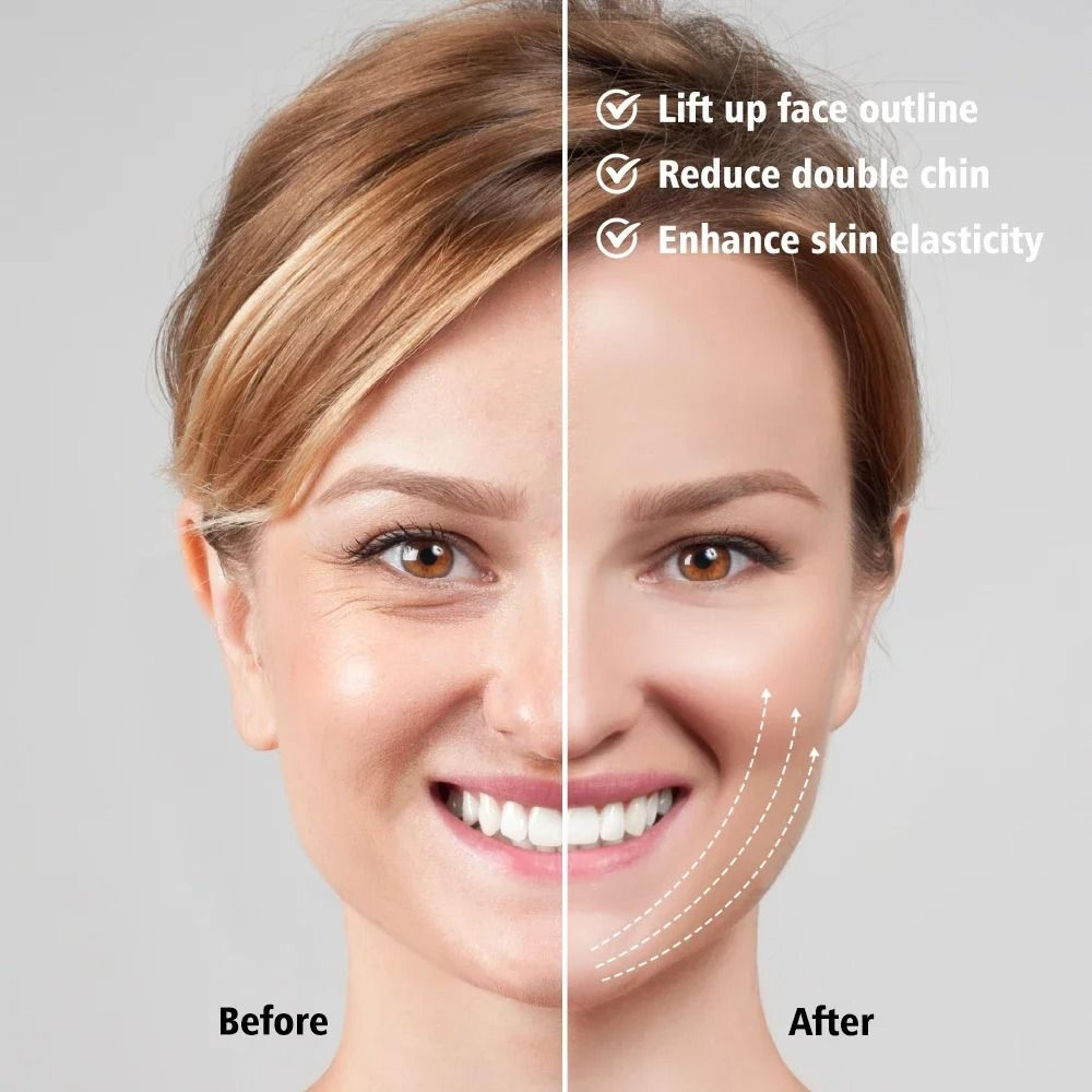 EMS Face Lifting Massager Microcurrent Facial Device V Face Lift Anti Wrinkle Tool 4