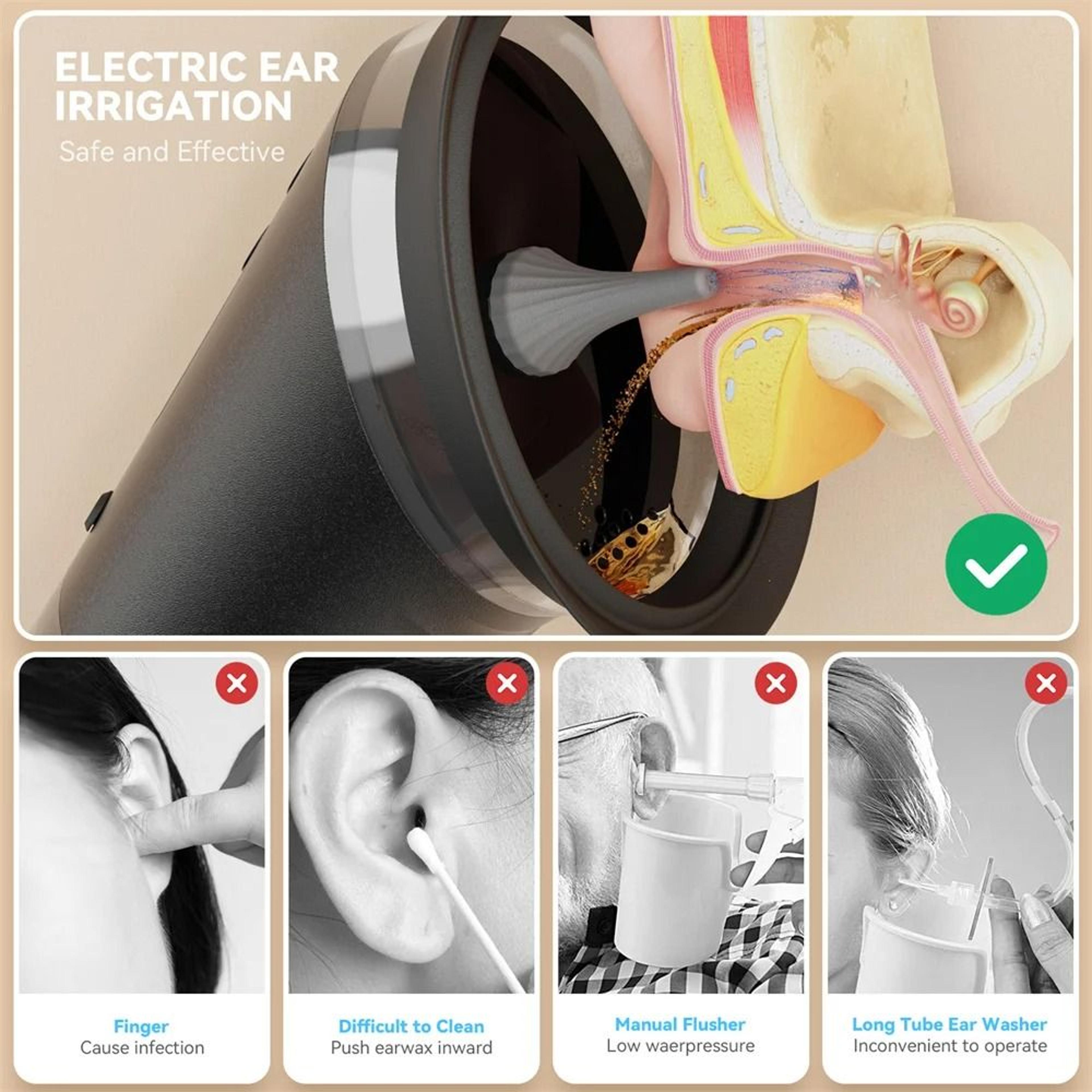 ClearFlow Electric Ear Wax Removal System With Adjustable Water Pressure 3