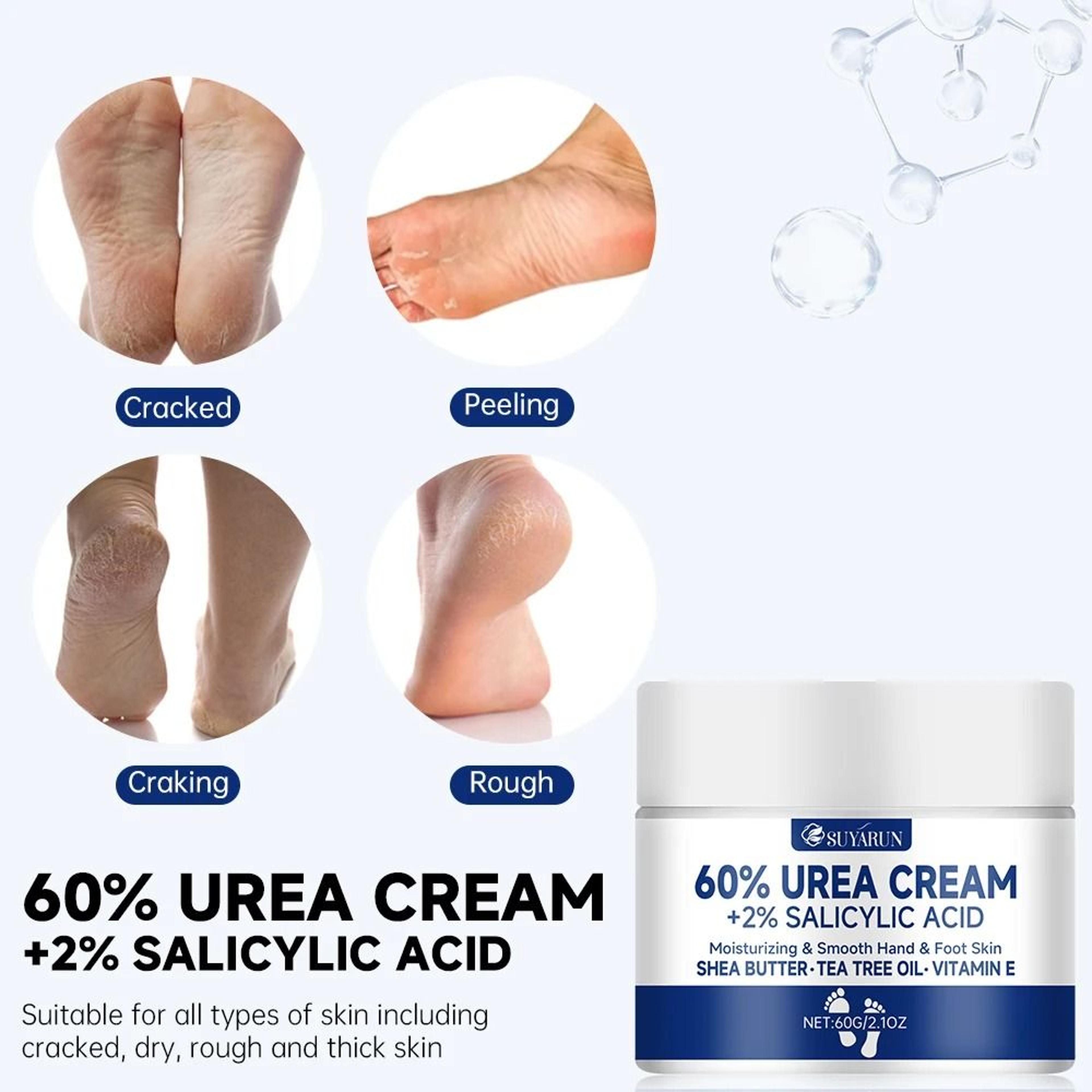 SUYARUN 60 Percent Urea Foot Cream For Cracked Heels And Callus Care 6