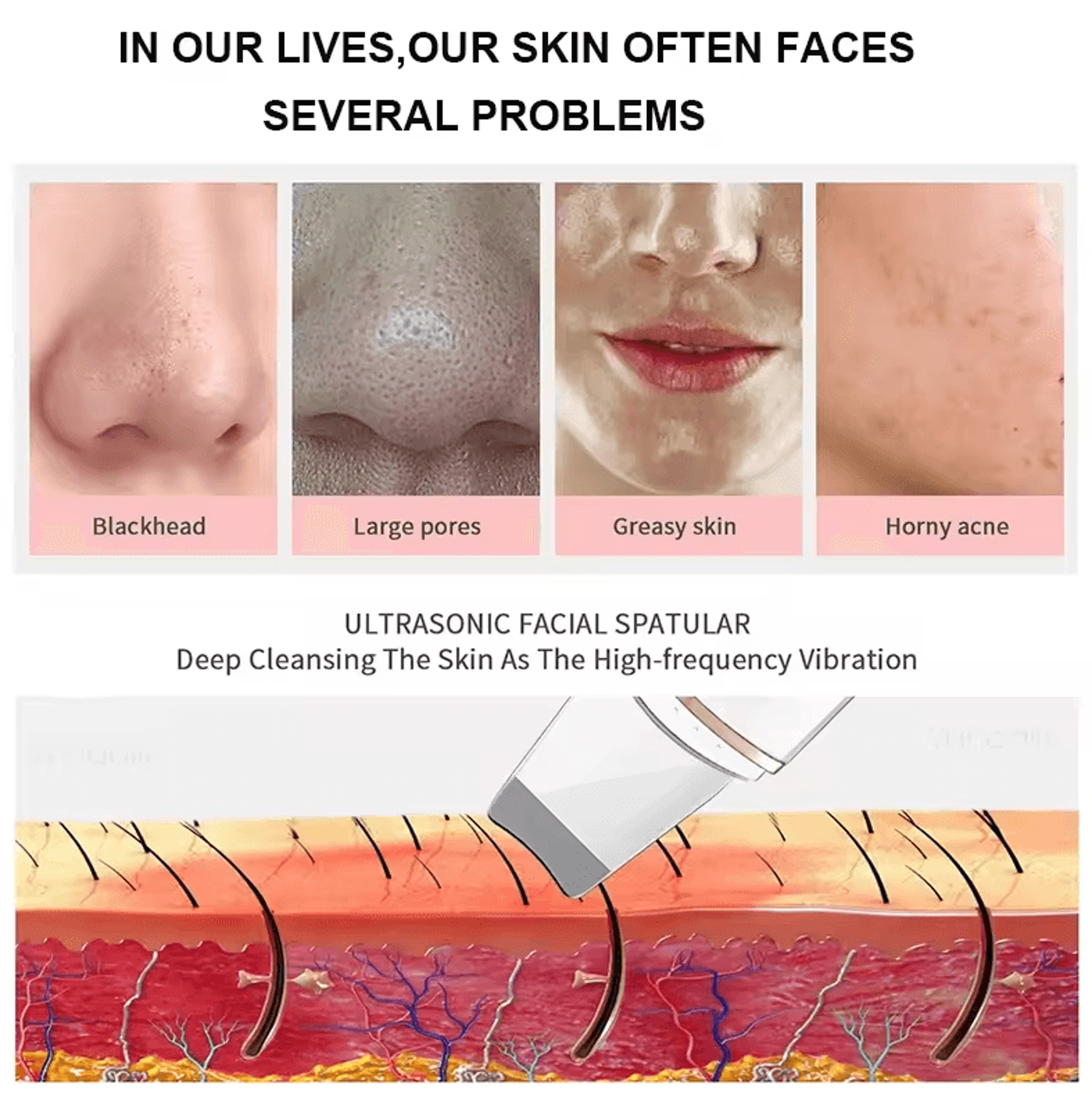 Ultrasonic Skin Scrubber Face Spatula  Deep Cleansing Blackhead Remover Tool 4