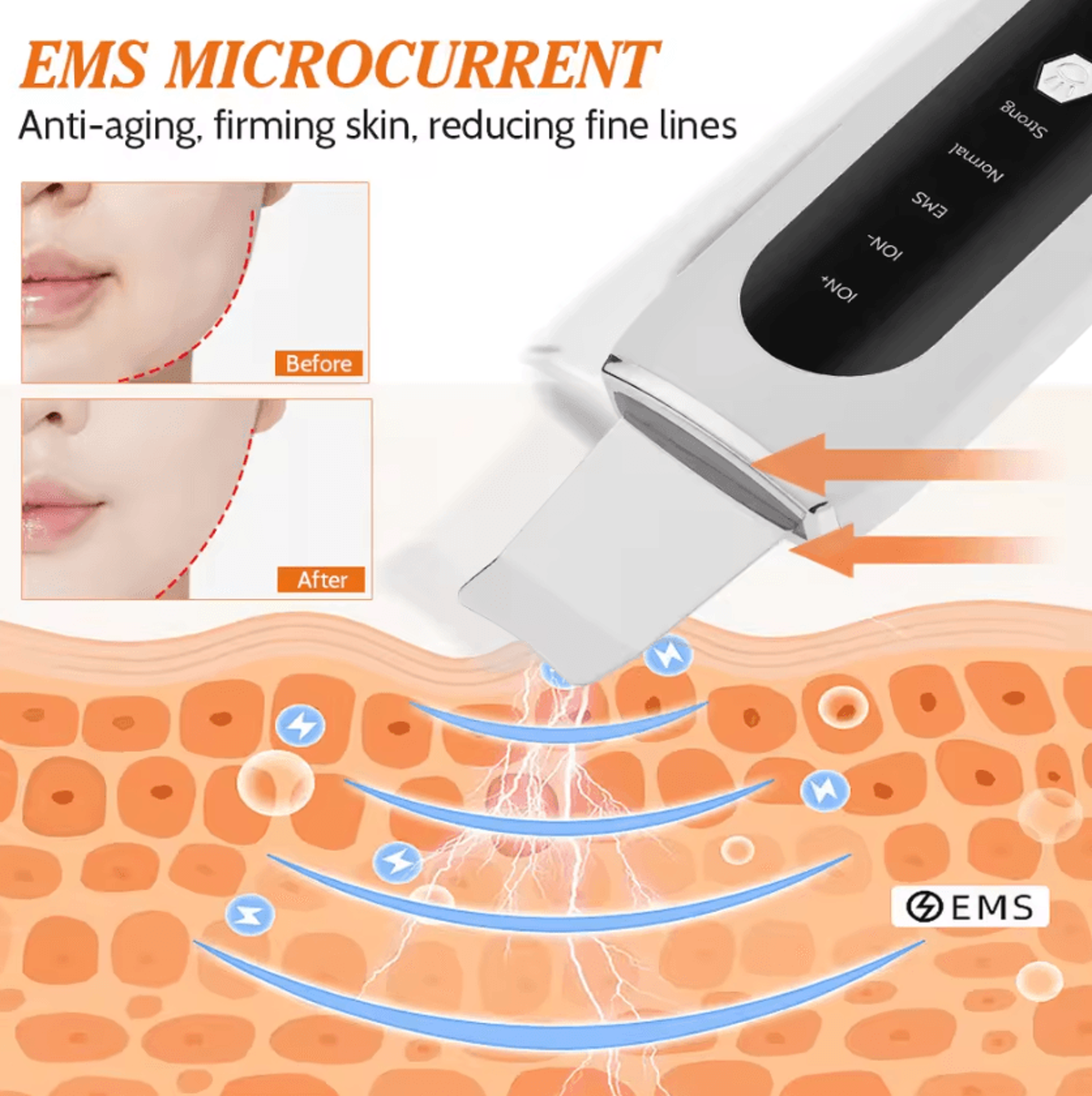 Ultrasonic Skin Scrubber Blackhead Remover Deep Pore Facial Cleanser 1
