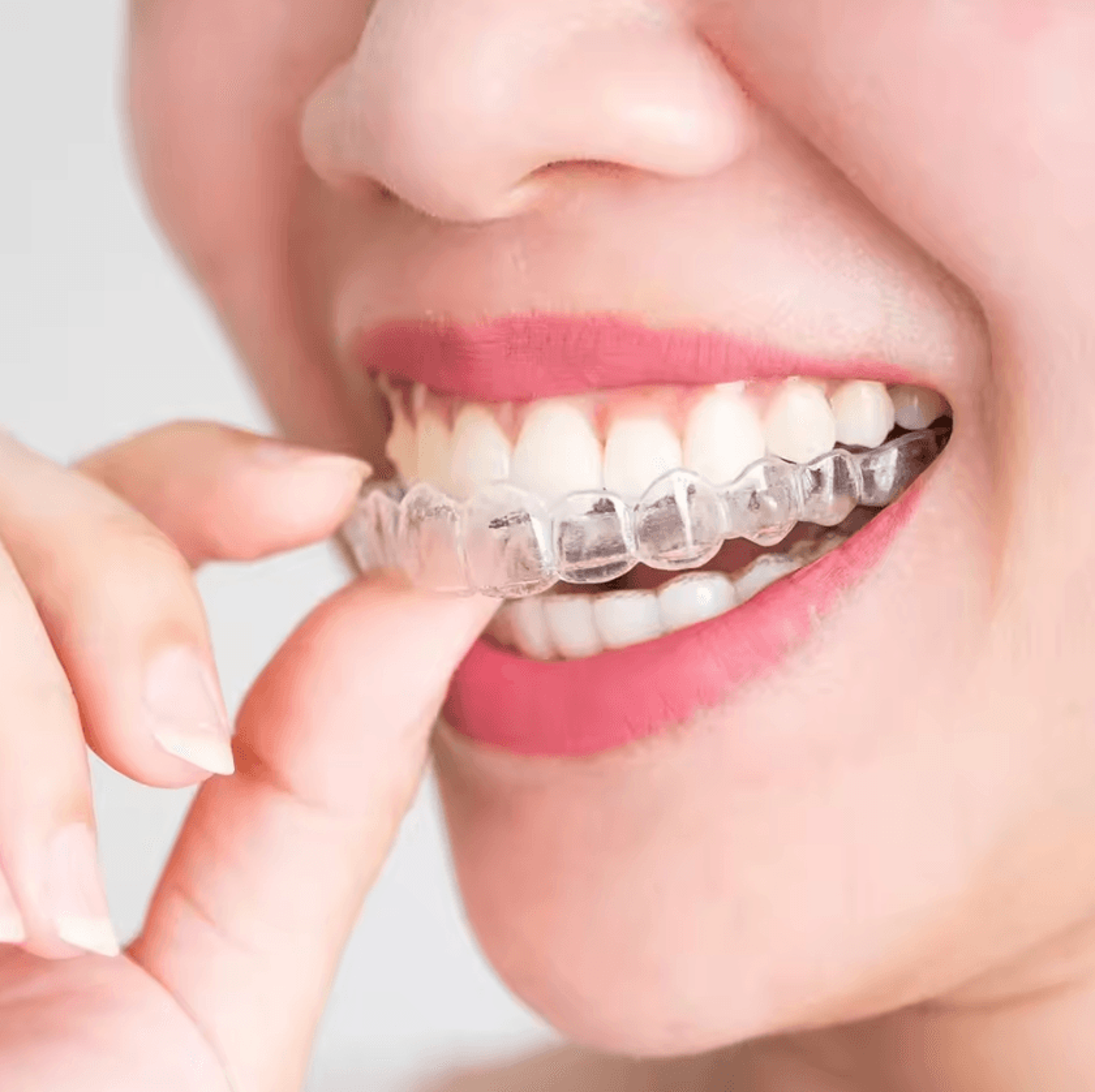 EVA Mouth Guard For Teeth Grinding Sports And Teeth Whitening 1