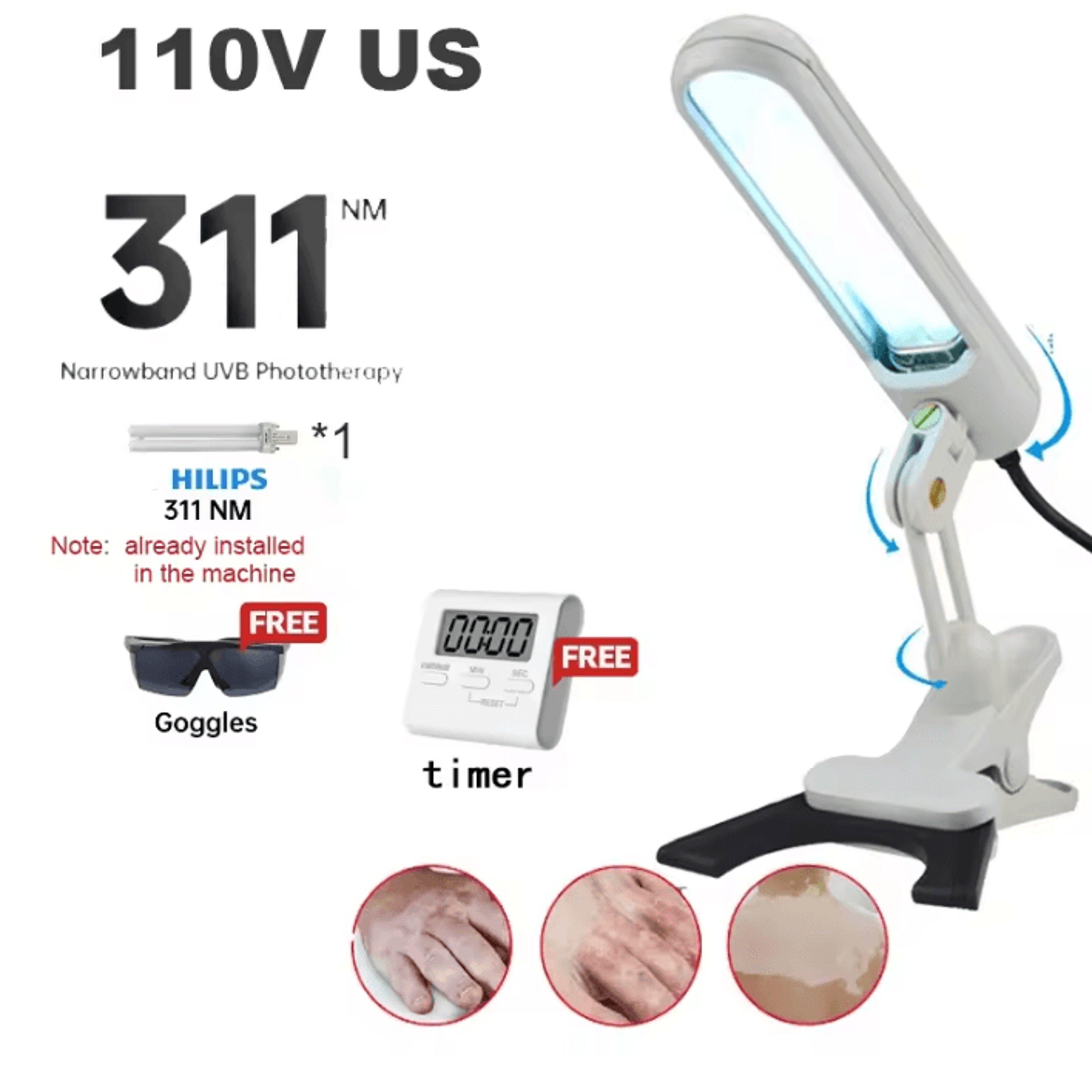311nm Narrowband UVB Home Phototherapy Lamp 6