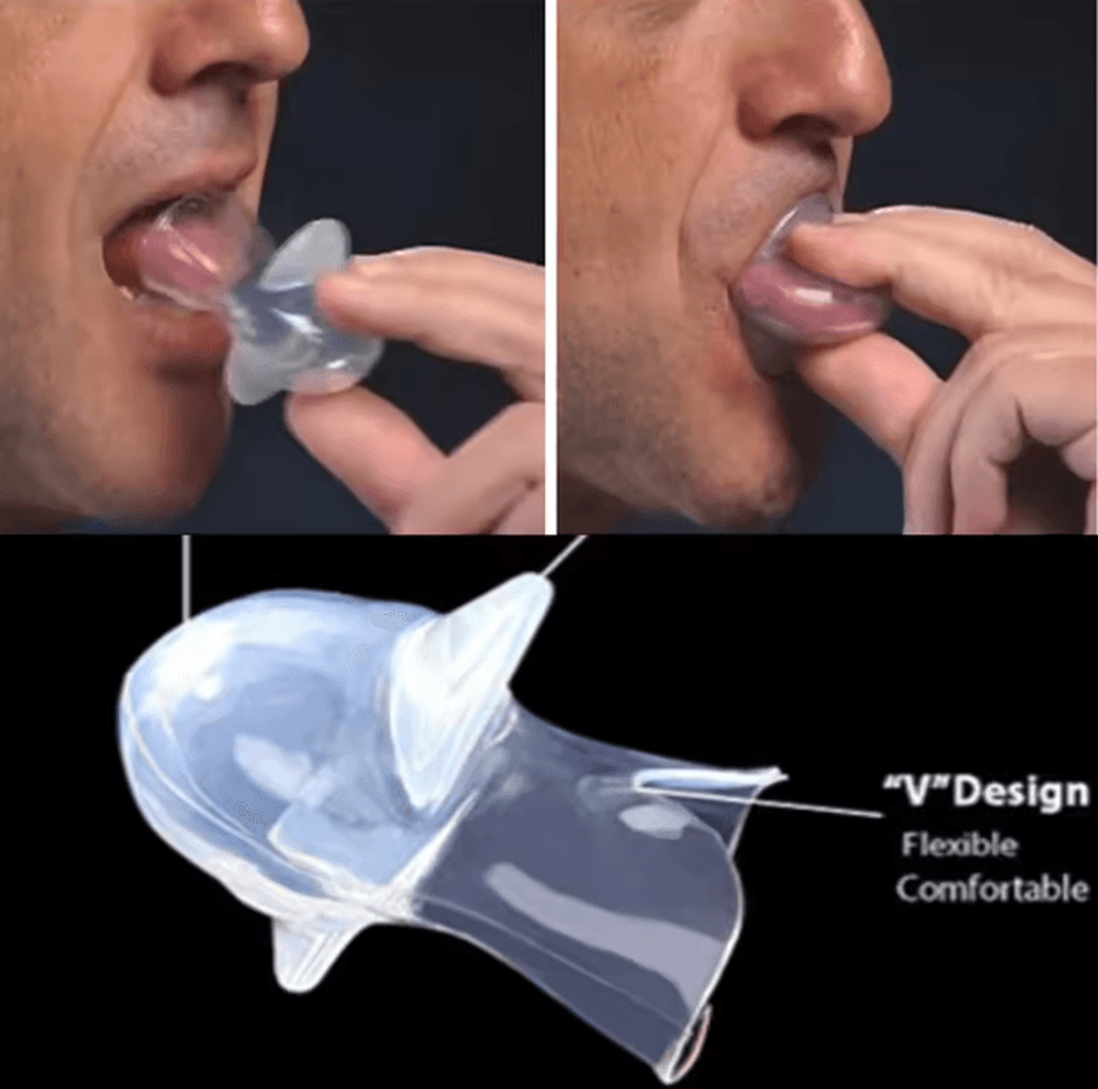 sleephold silicone tongue retainer for snoring support