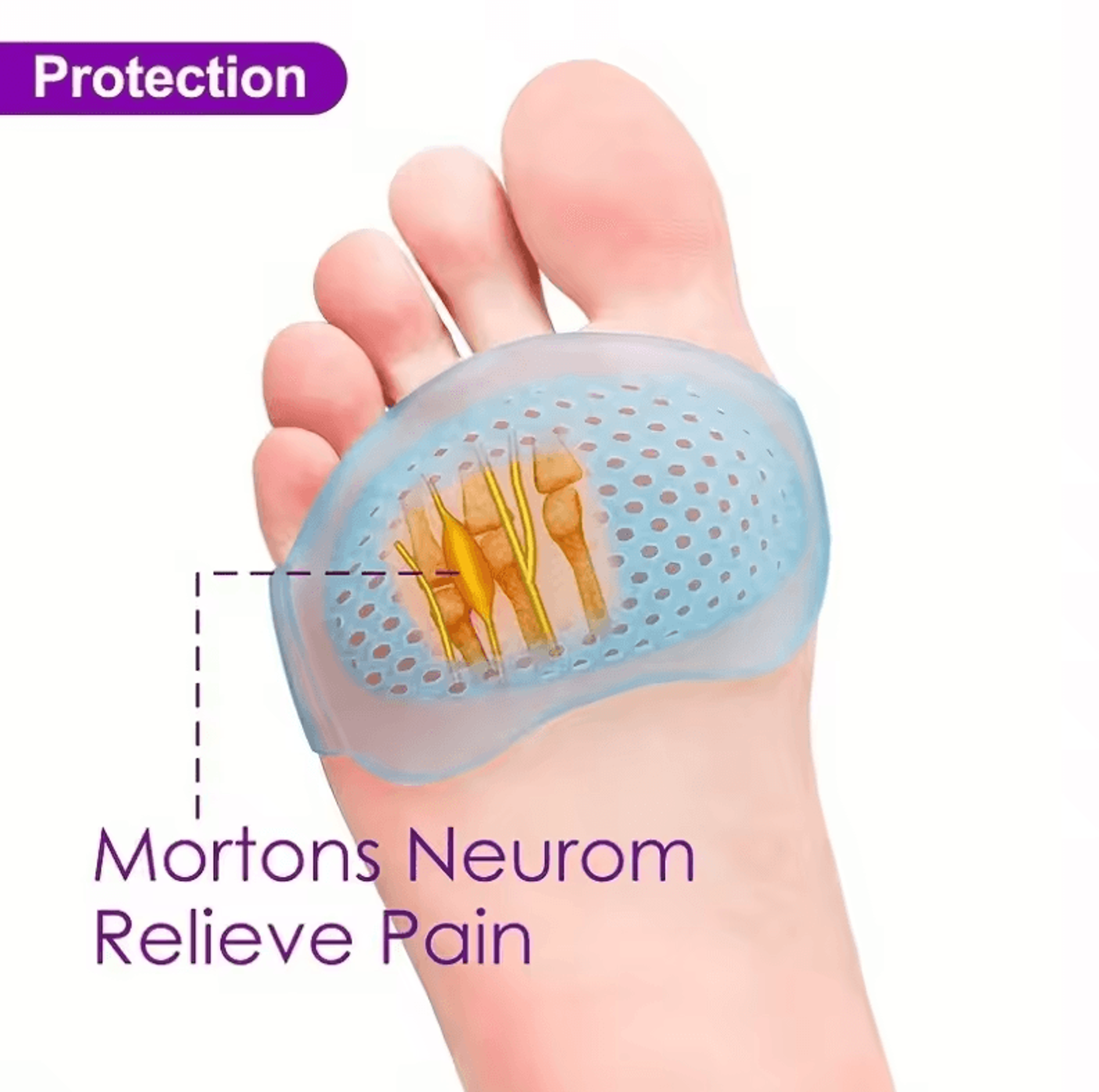 Silicone Metatarsal Pads For Arch Support  Pain Relief  Gel Cushions For Running Comfort 0