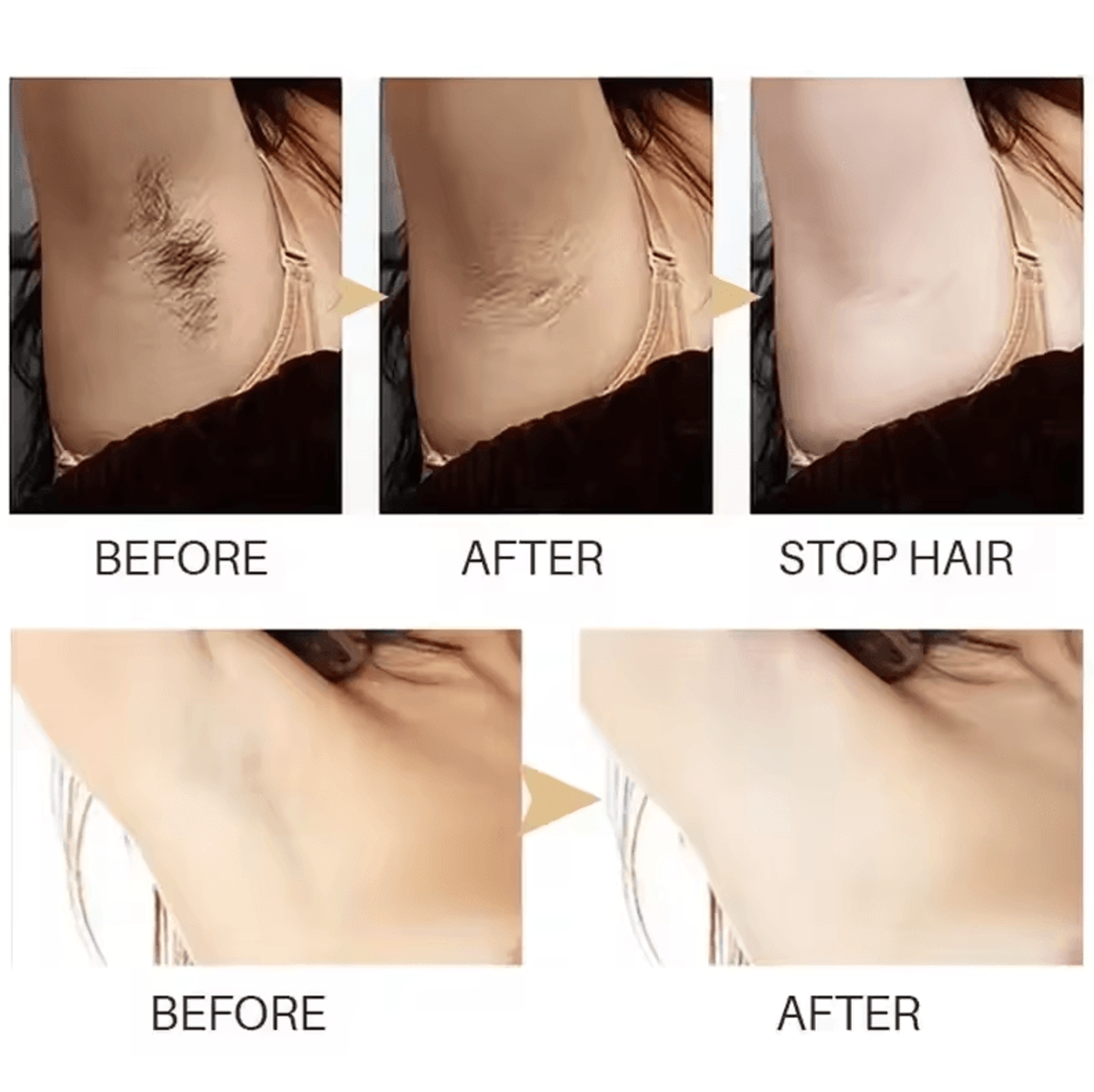 Painless Hair Remover Cream With Hair Growth Inhibition  Permanent Removal Inhibitor For Body Bikin 2