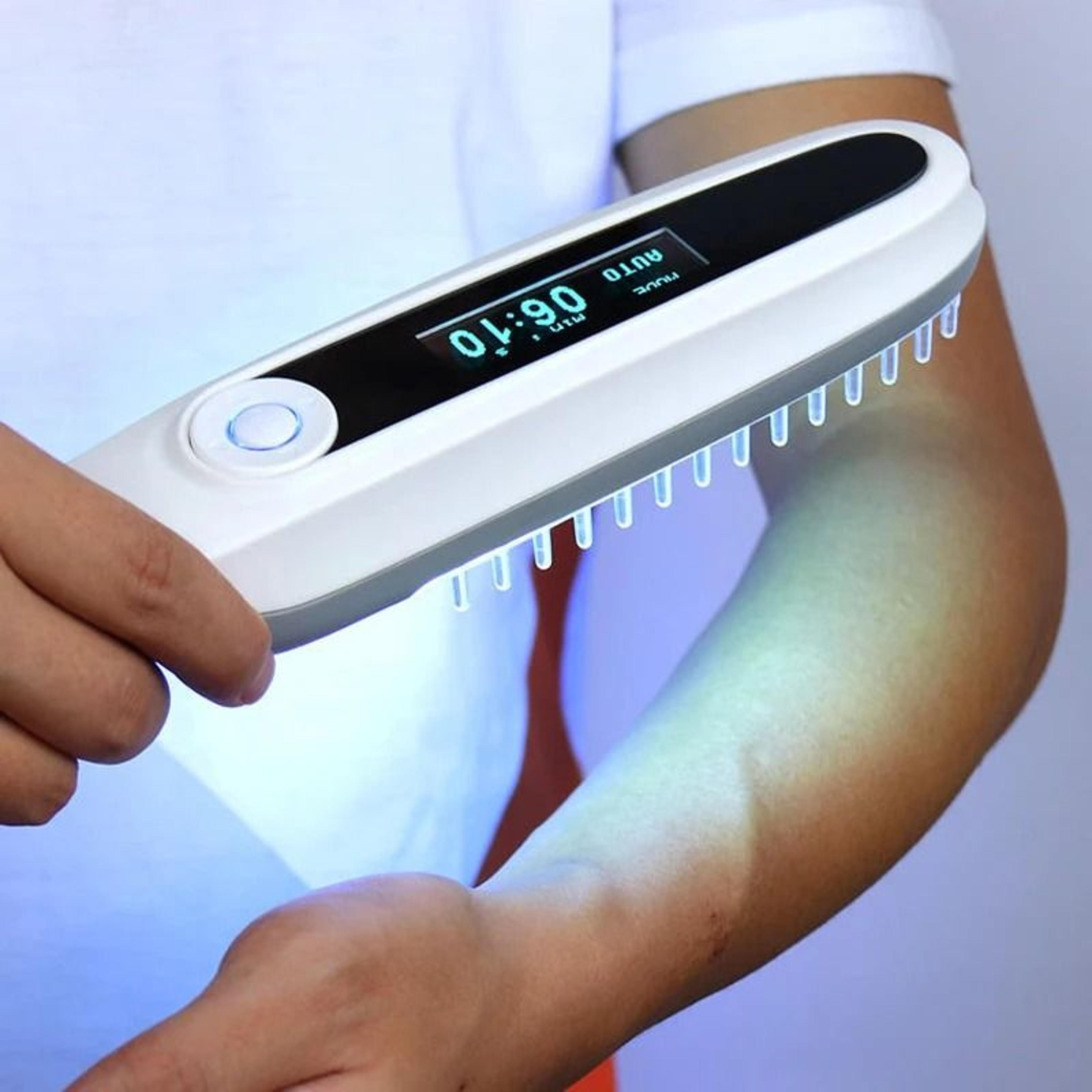 Narrowband UVB Phototherapy Instrument And Target Spectrum Clearance Lamp 4