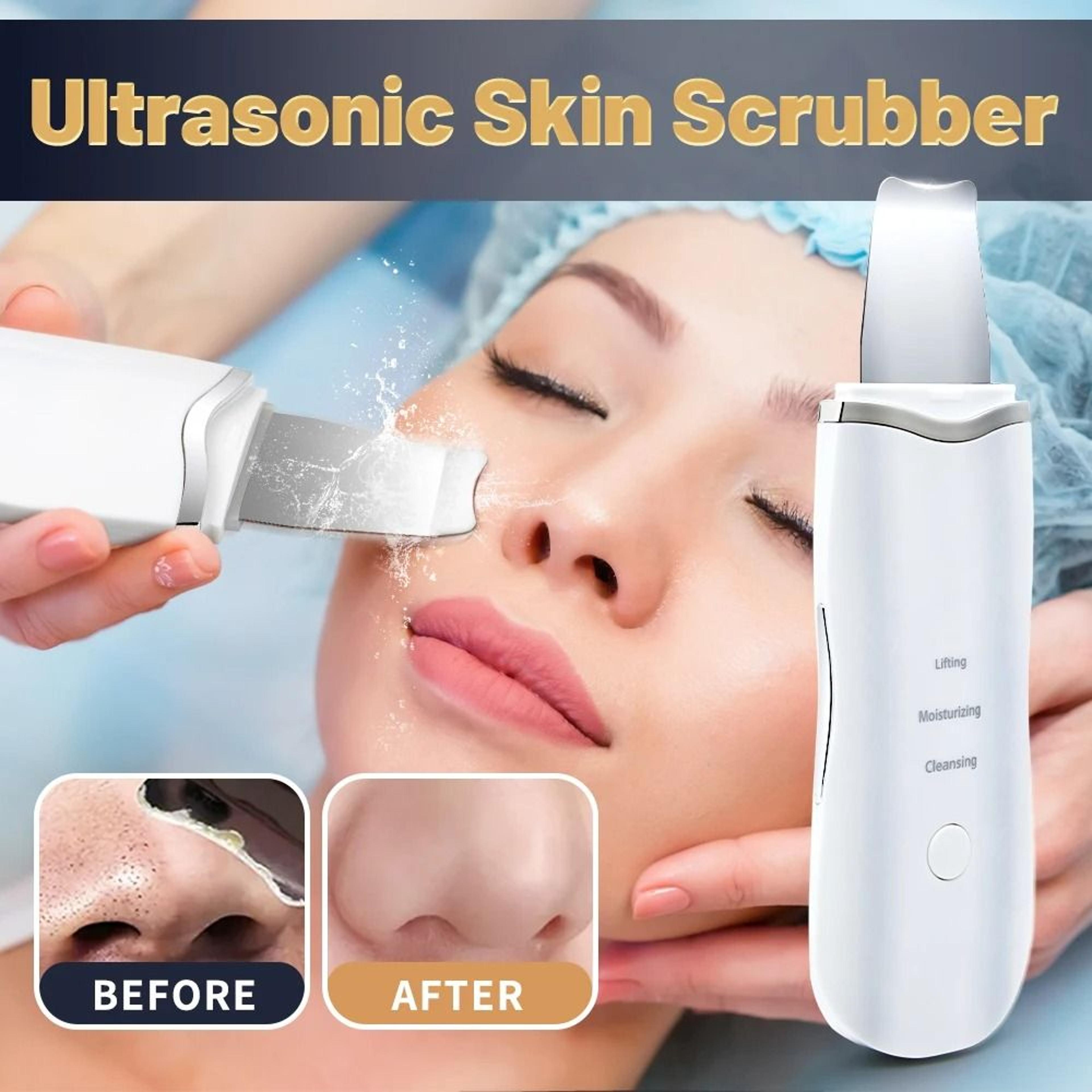 ultrasonic deep pore cleansing shovel and ion facial skin scrubber