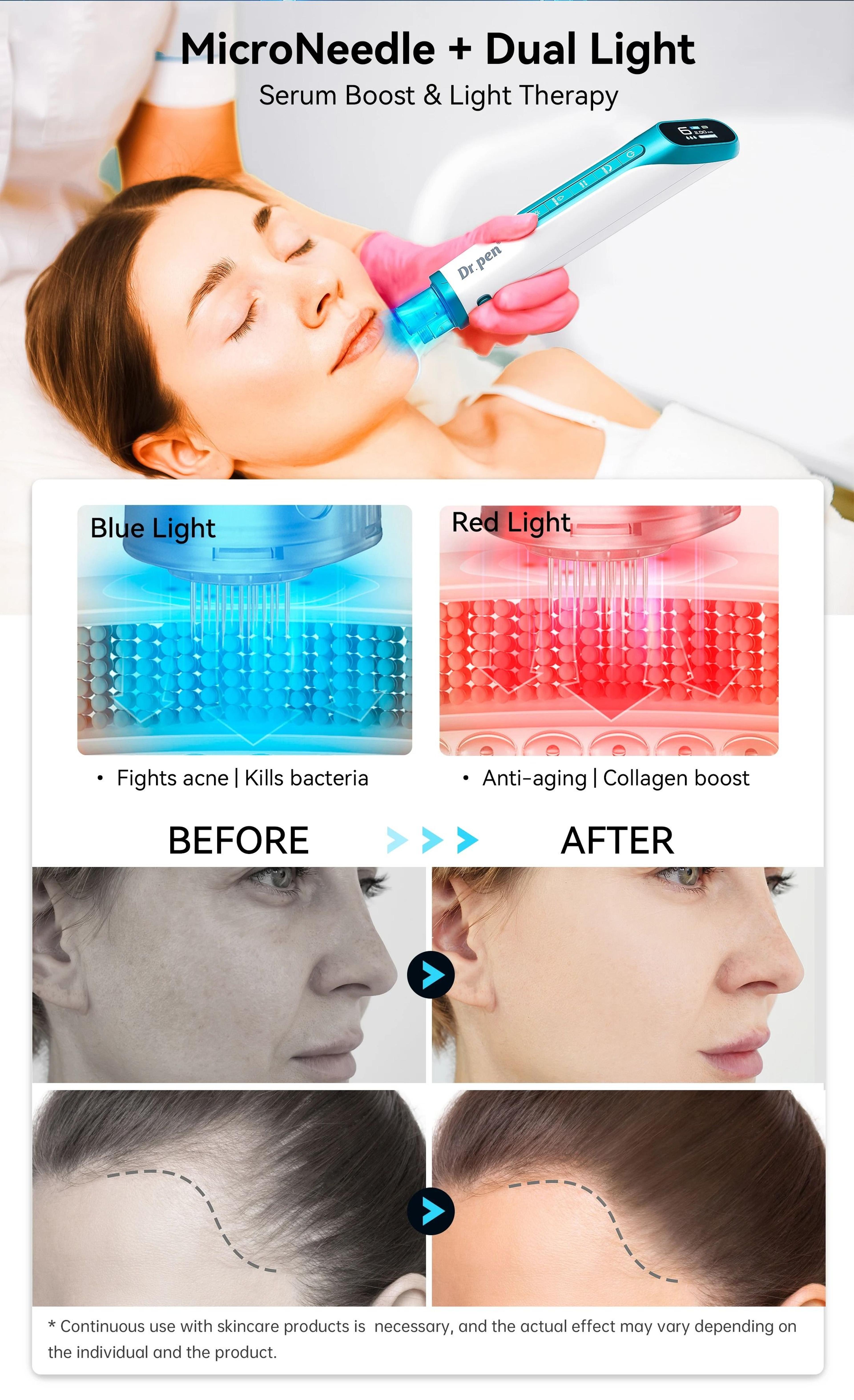 Hydra Pen H6 Advanced Serum Infusion Microneedling And LED Phototherapy System 4