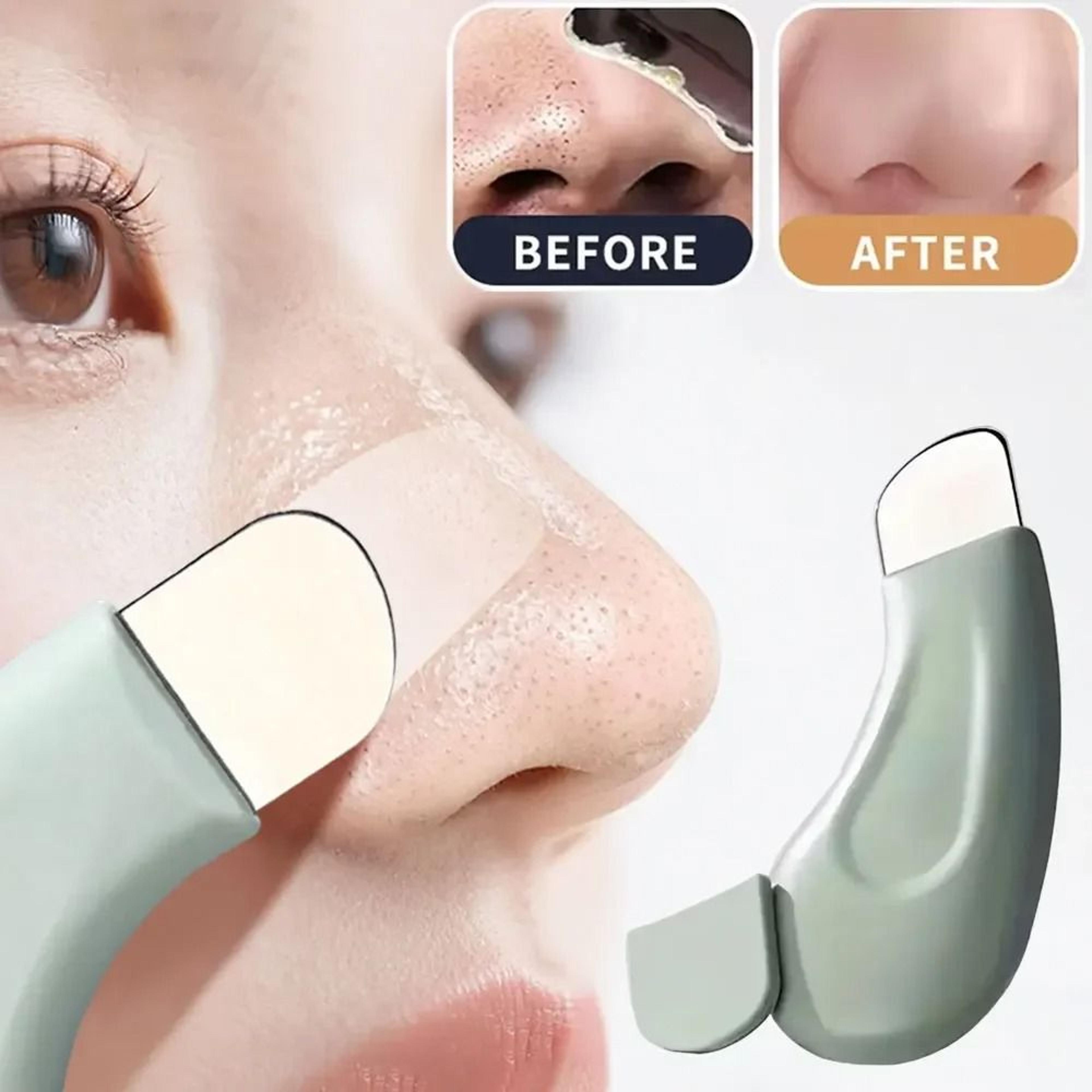 deep cleansing blackhead and whitehead removal ultrasonic face scrubber