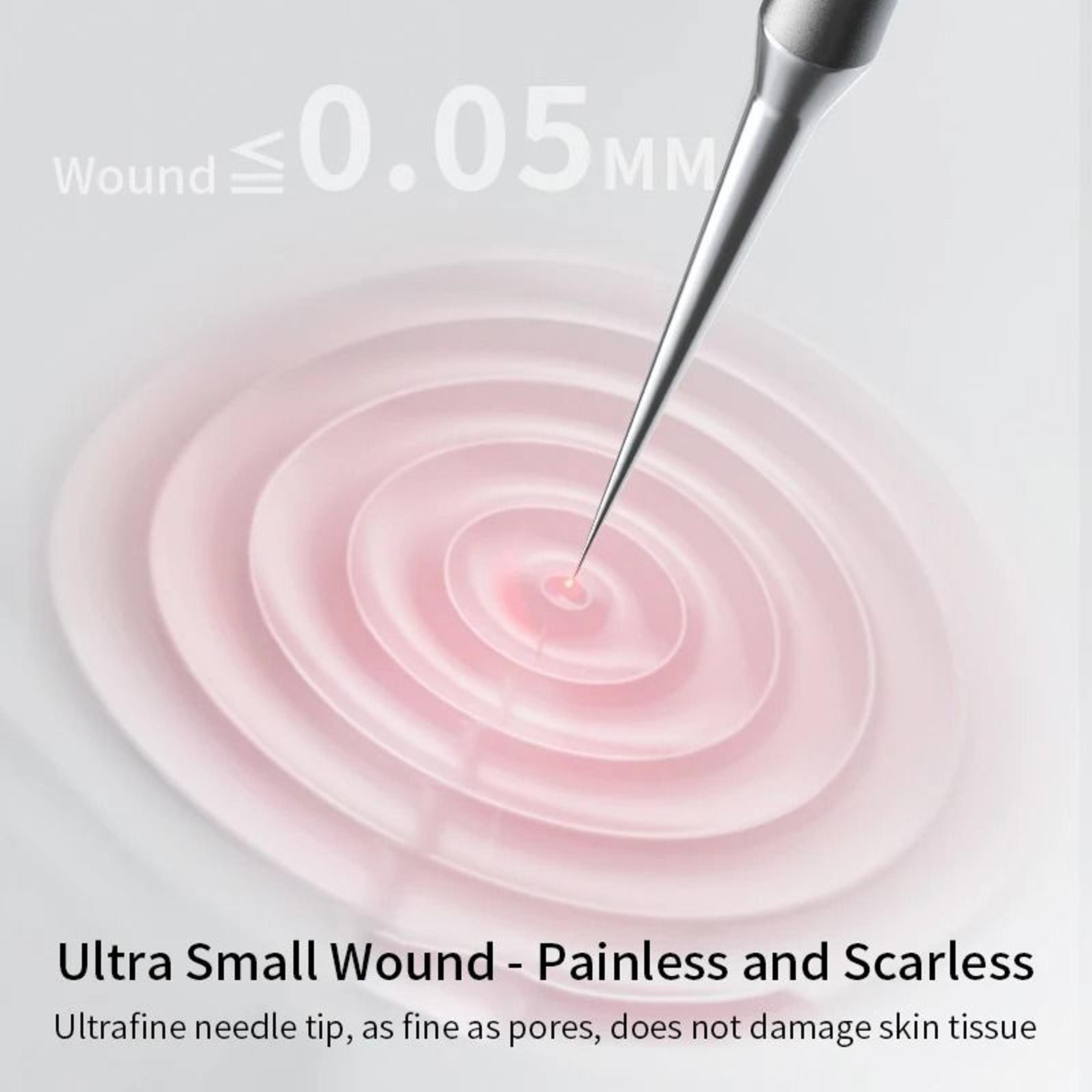 UltraFine Blemish Extraction And Blackhead Removal Tool Set 4